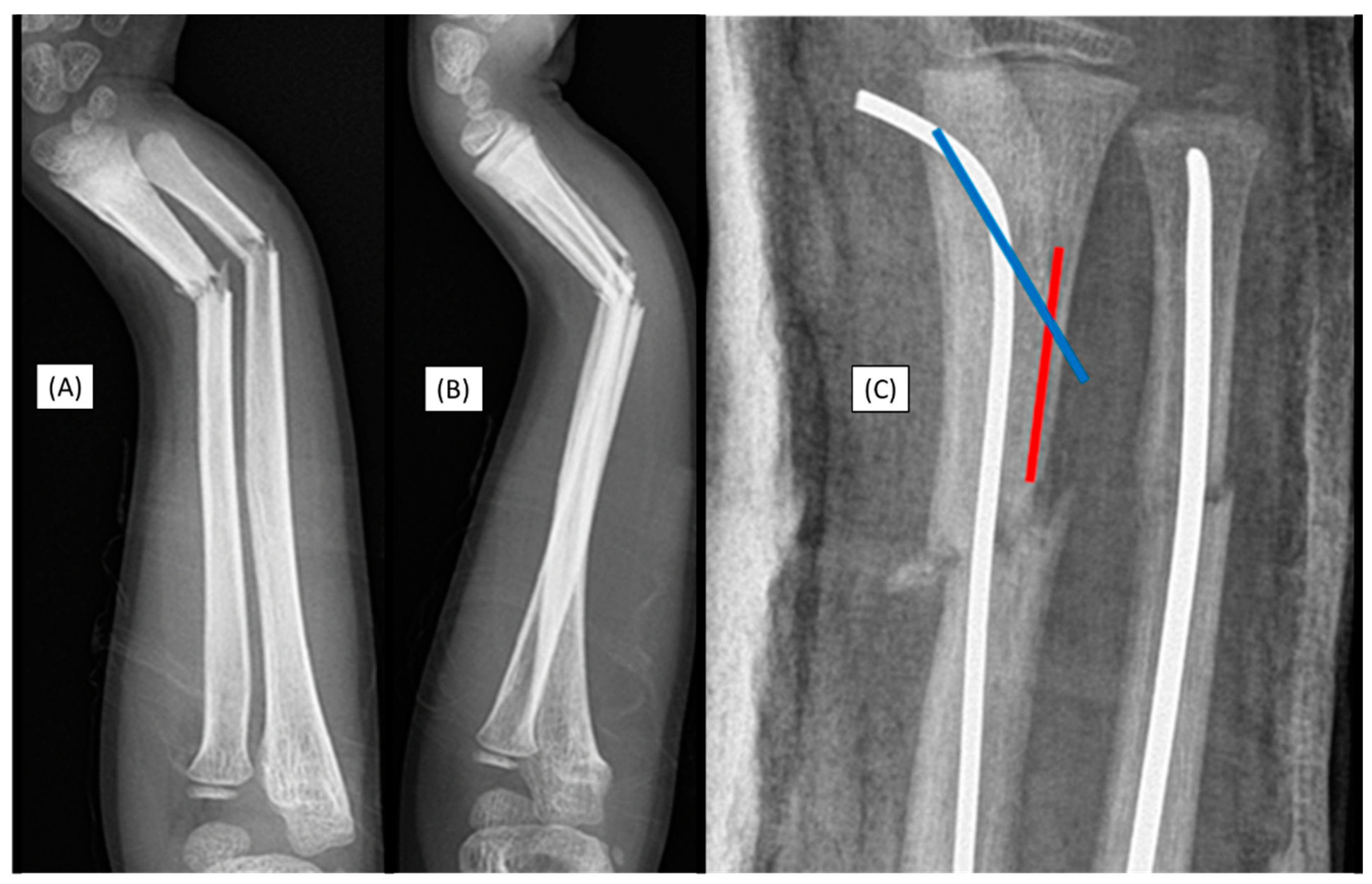 Preprints 149314 g001