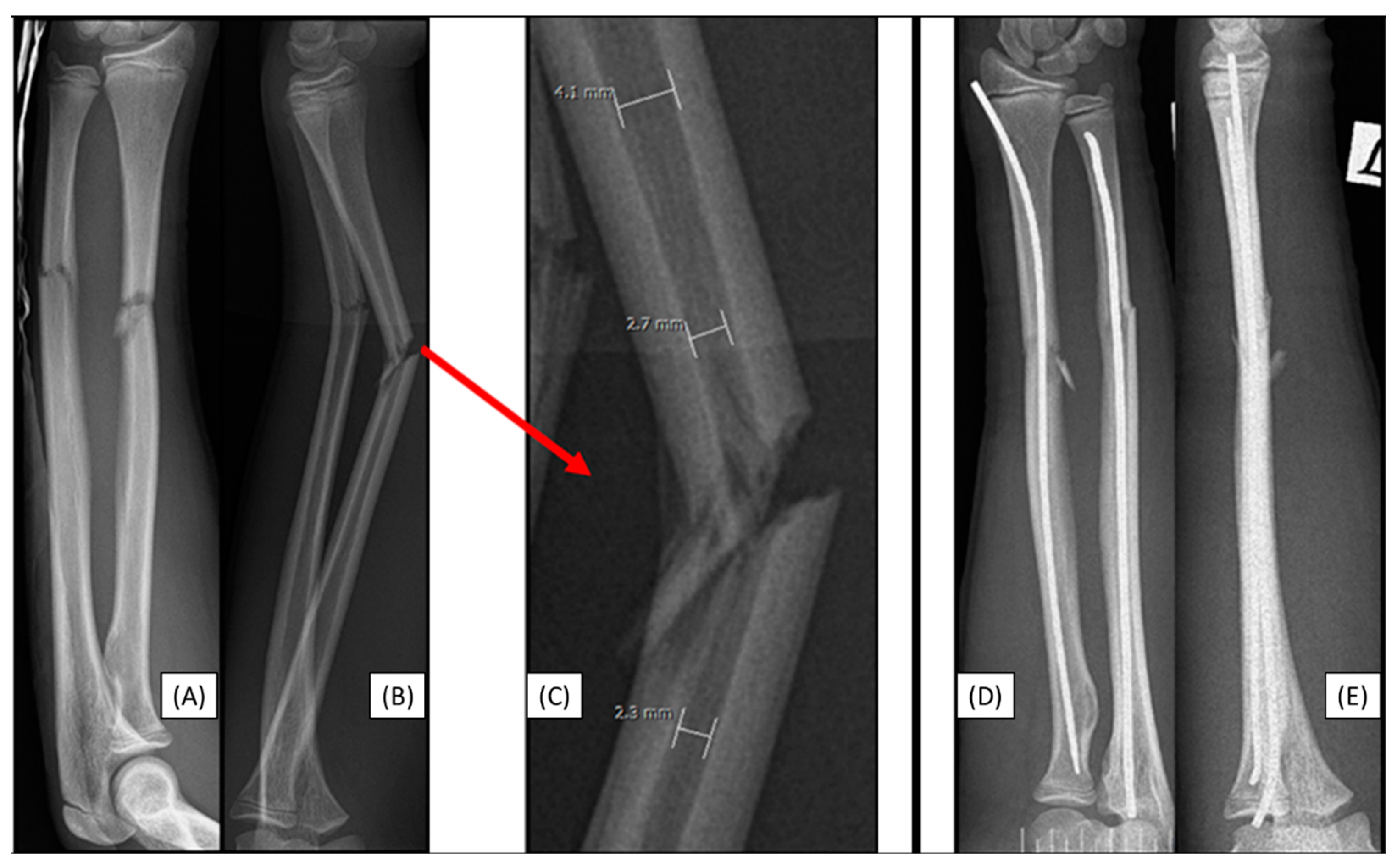 Preprints 149314 g002