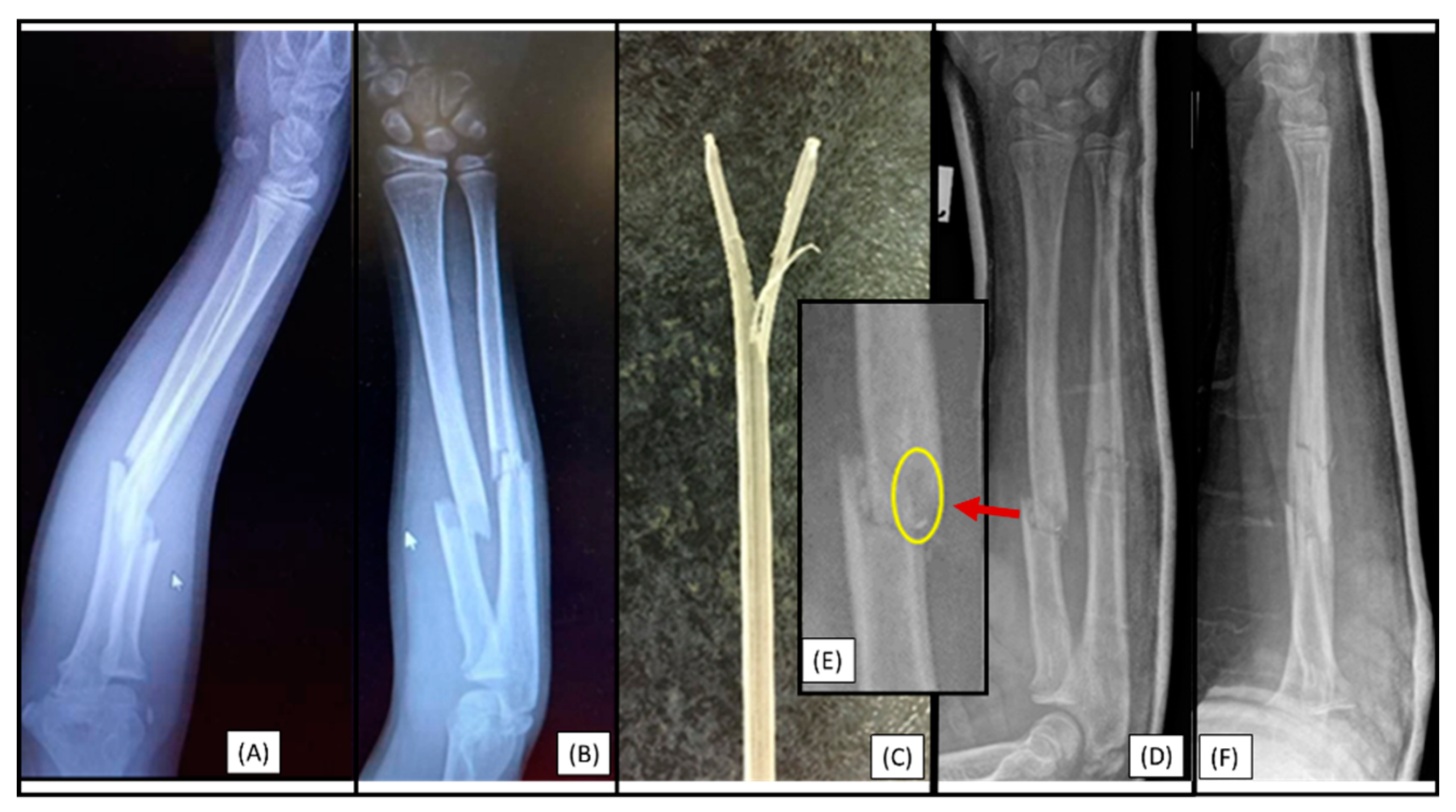 Preprints 149314 g003