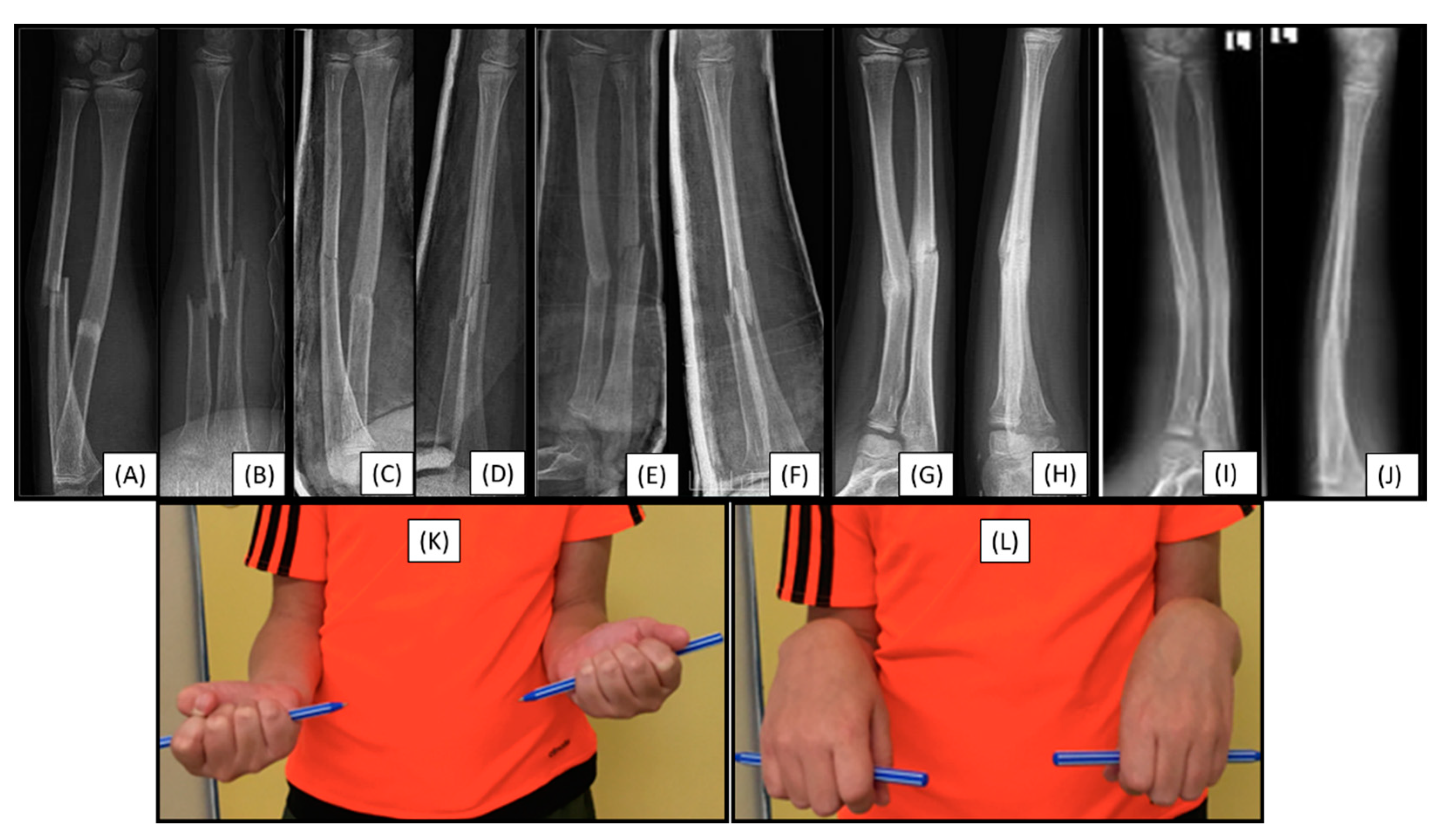 Preprints 149314 g005