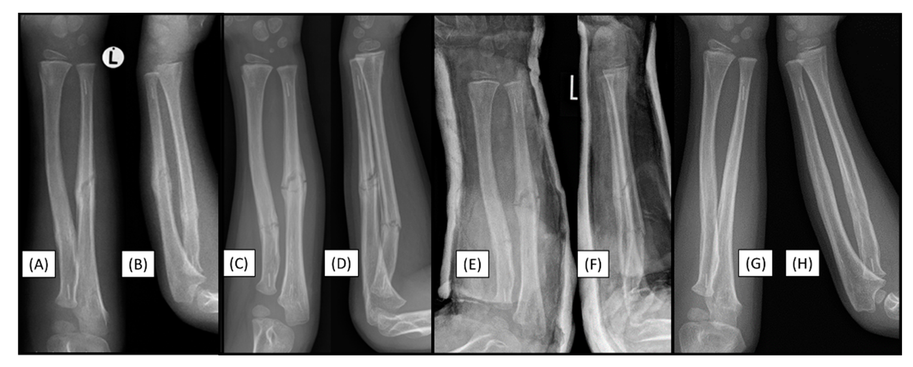 Preprints 149314 g006