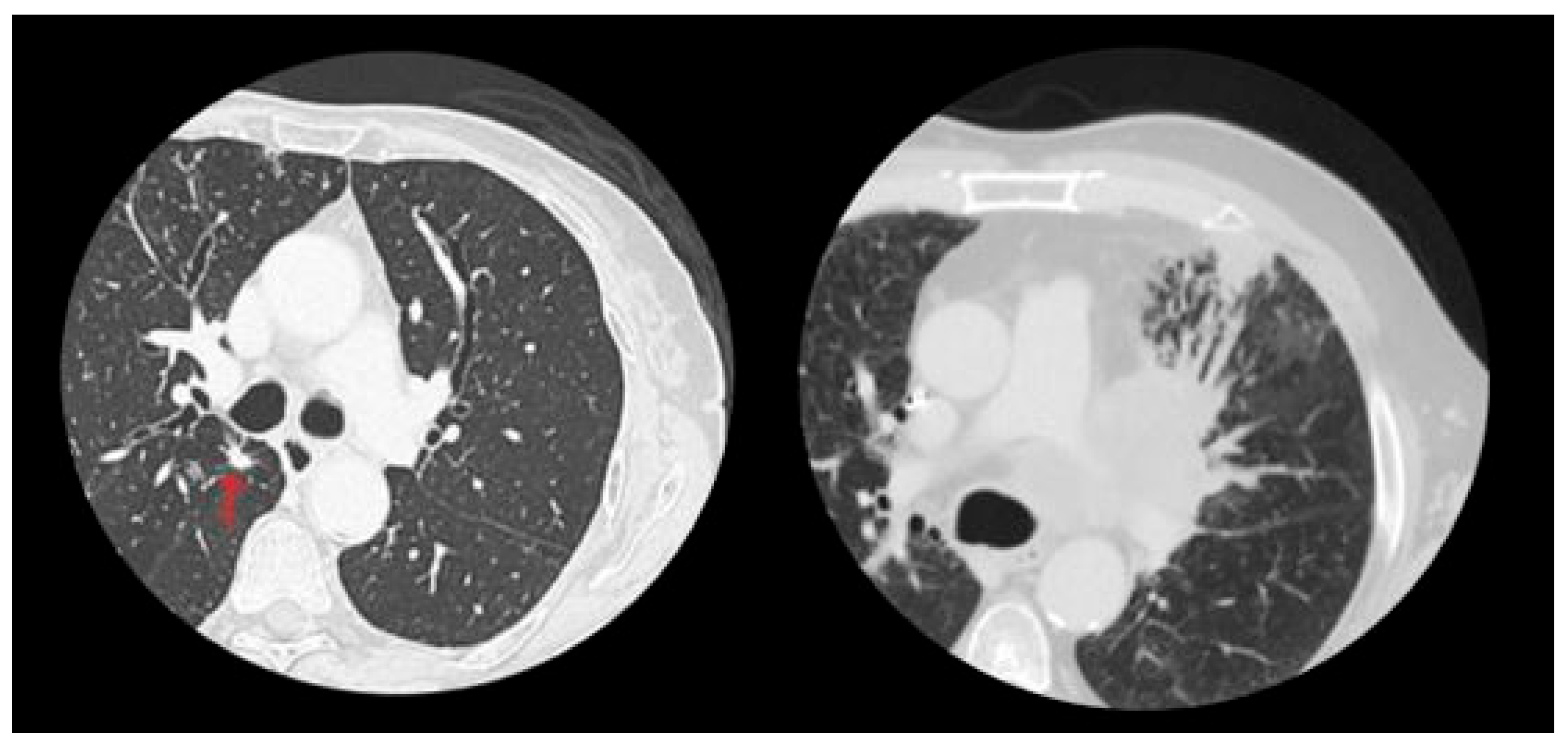 Preprints 143256 g002