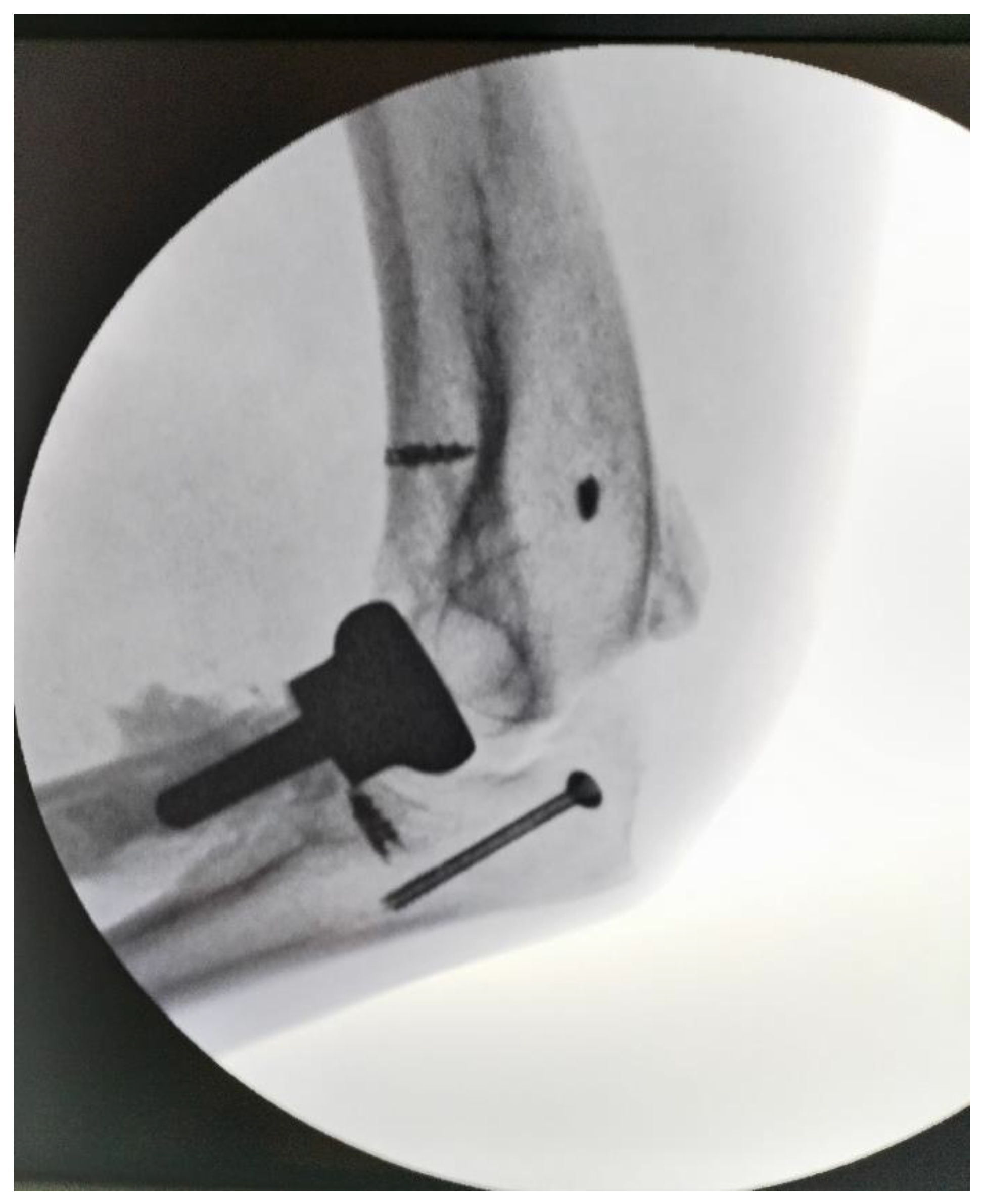 Preprints 177174 g004