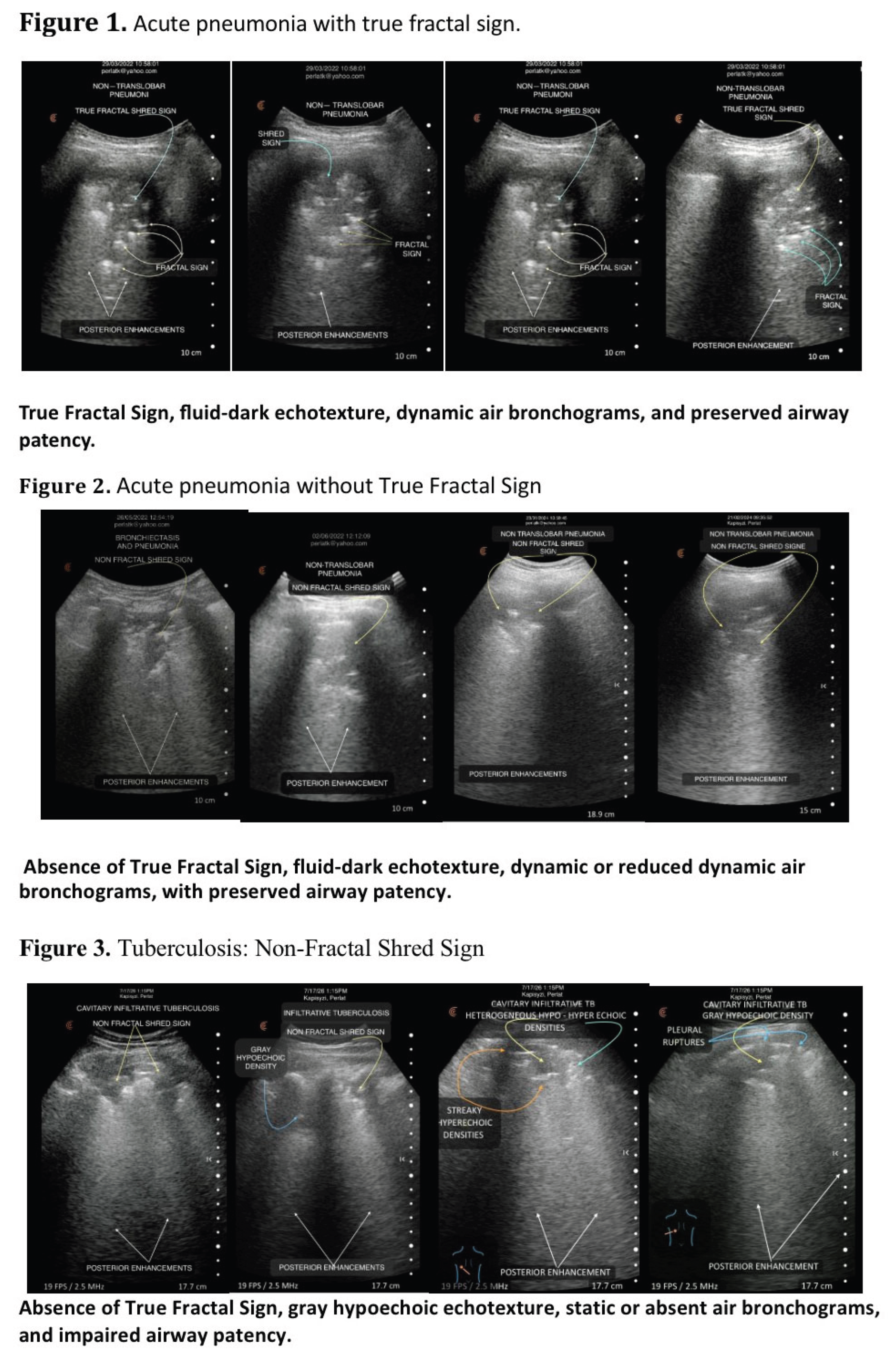 Preprints 225915 i001