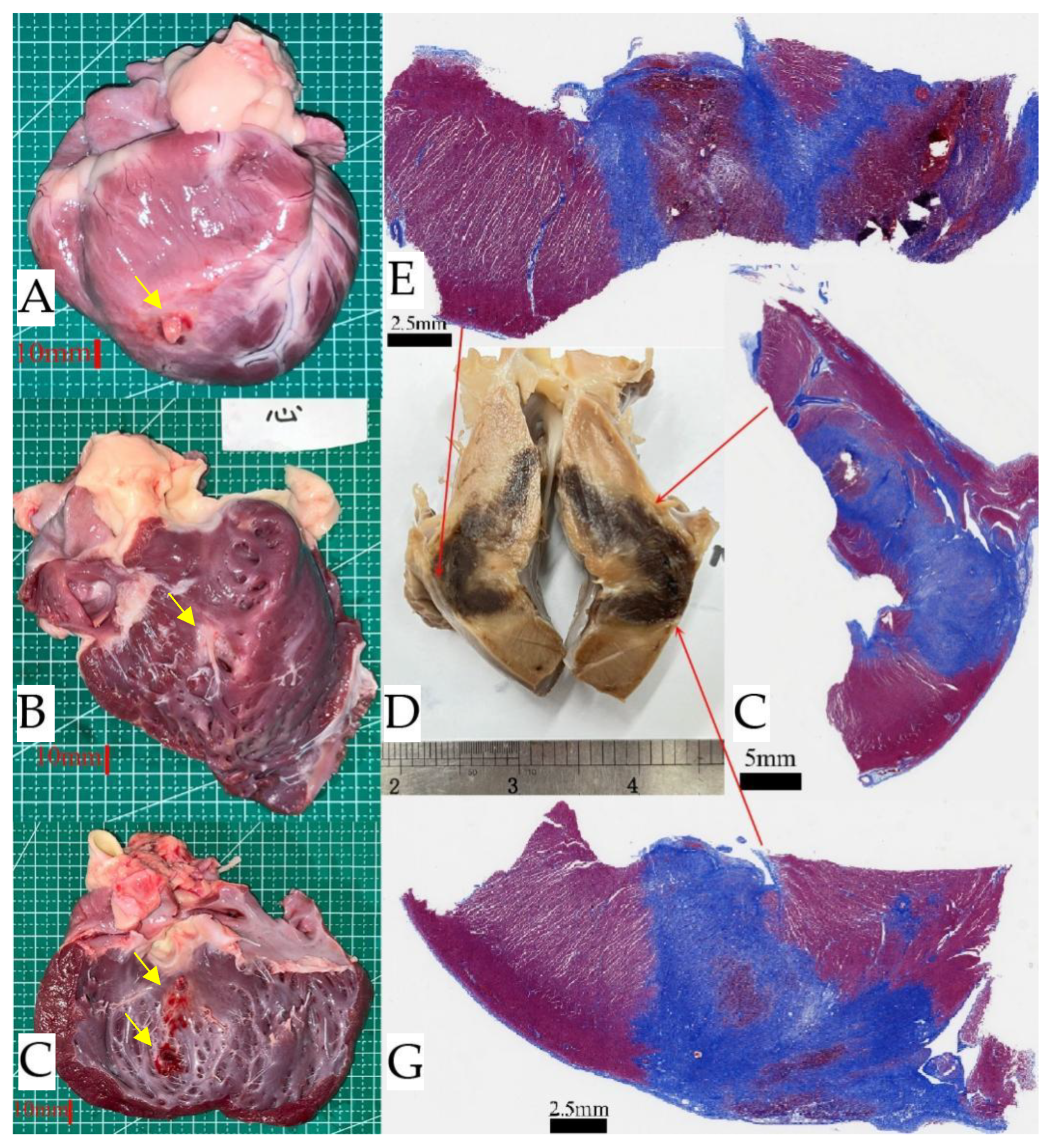 Percutaneous Intramyocardial Septal Ablation with Nanosecond