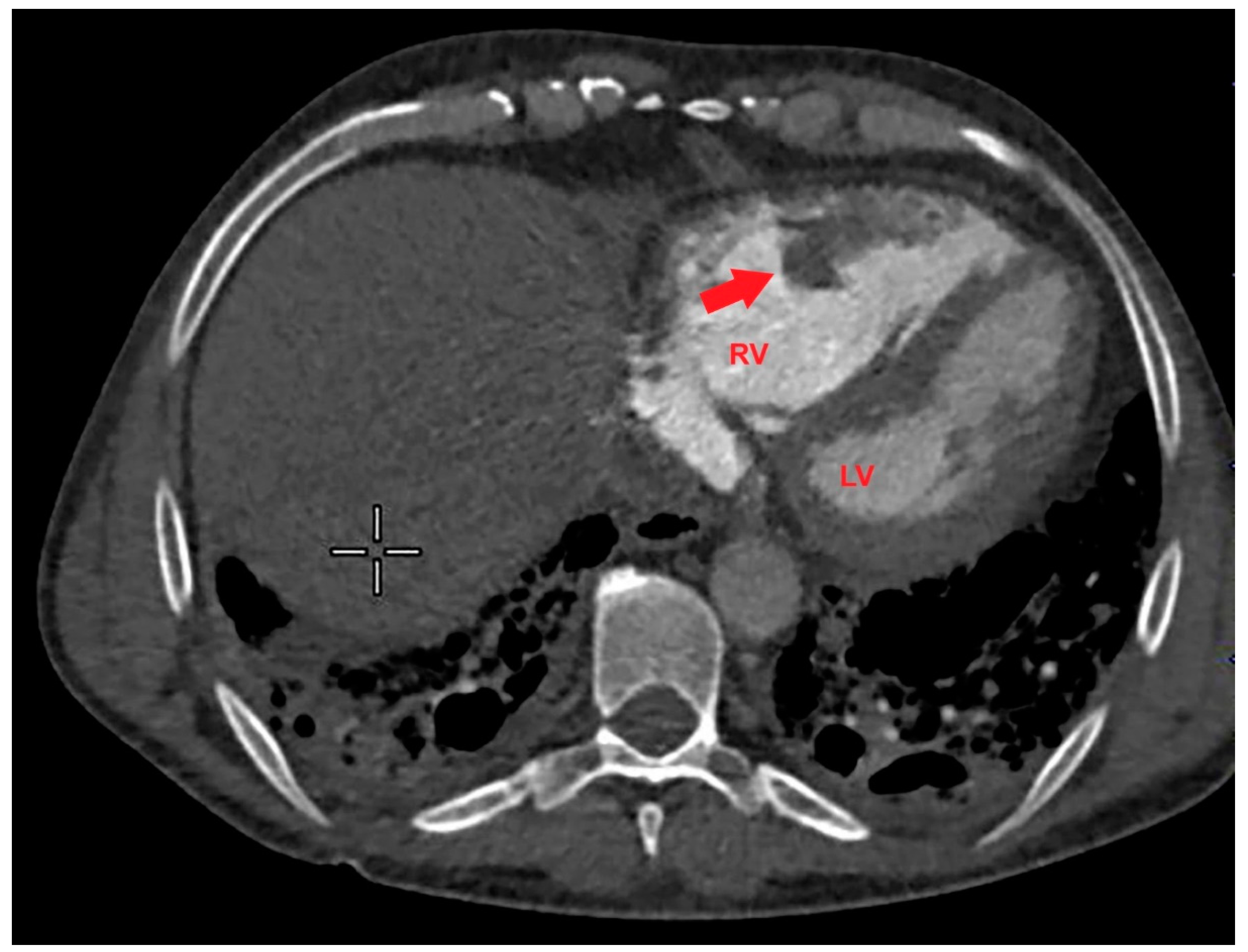 Preprints 150406 g004