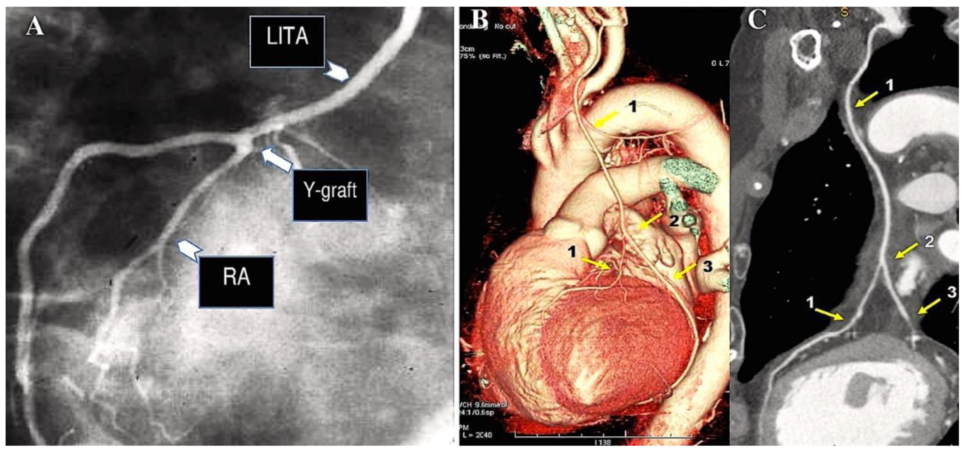 Preprints 138143 g004