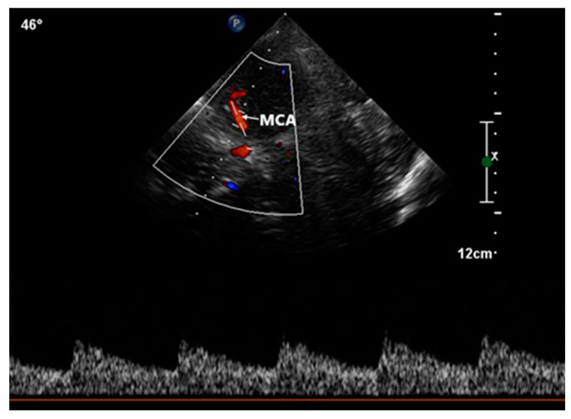 Preprints 83965 g004