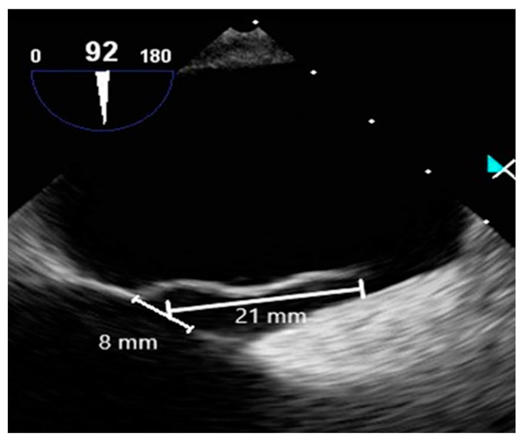 Preprints 83965 g006
