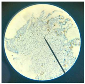 Preprints 172056 i001