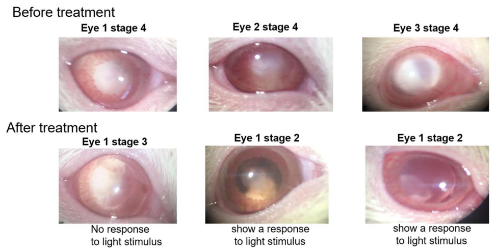 Curcumin Nanoemulsion: Characterization and Effect on Cataracts in an In Vivo Animal Model and Ex Vivo Human Model[v1]
