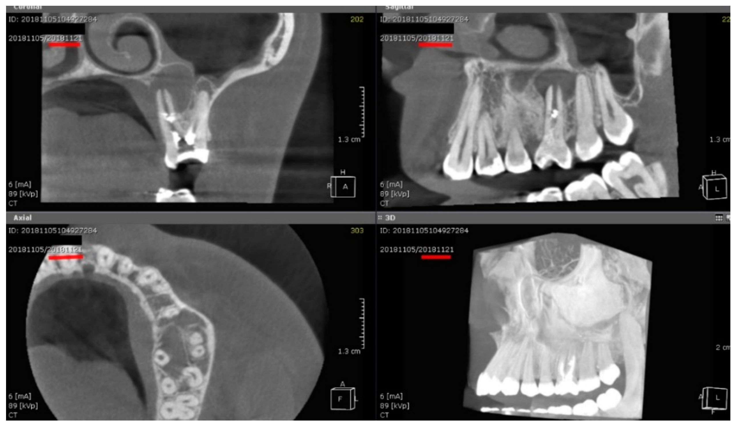 Preprints 156350 g001