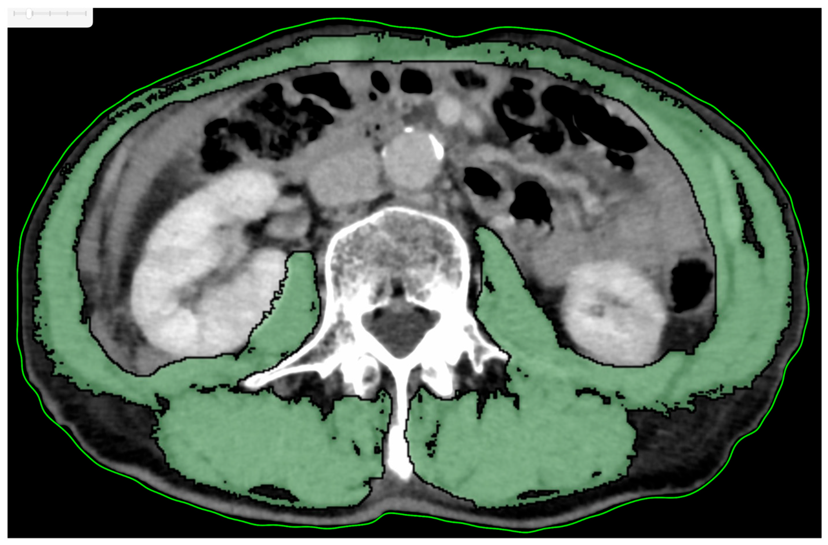 Preprints 159529 g001