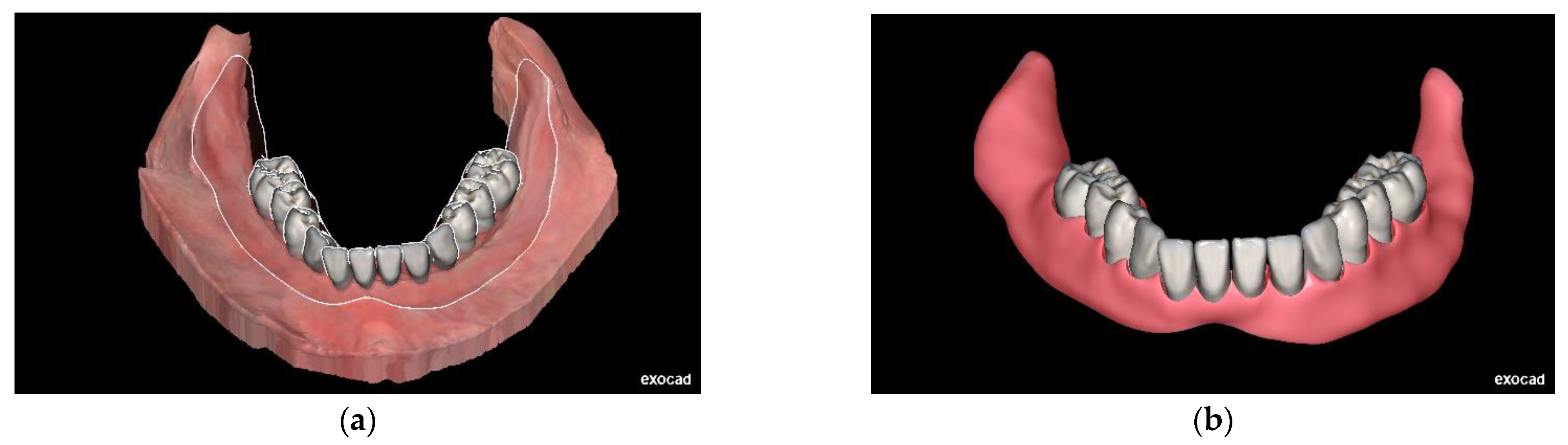 Preprints 140905 g003