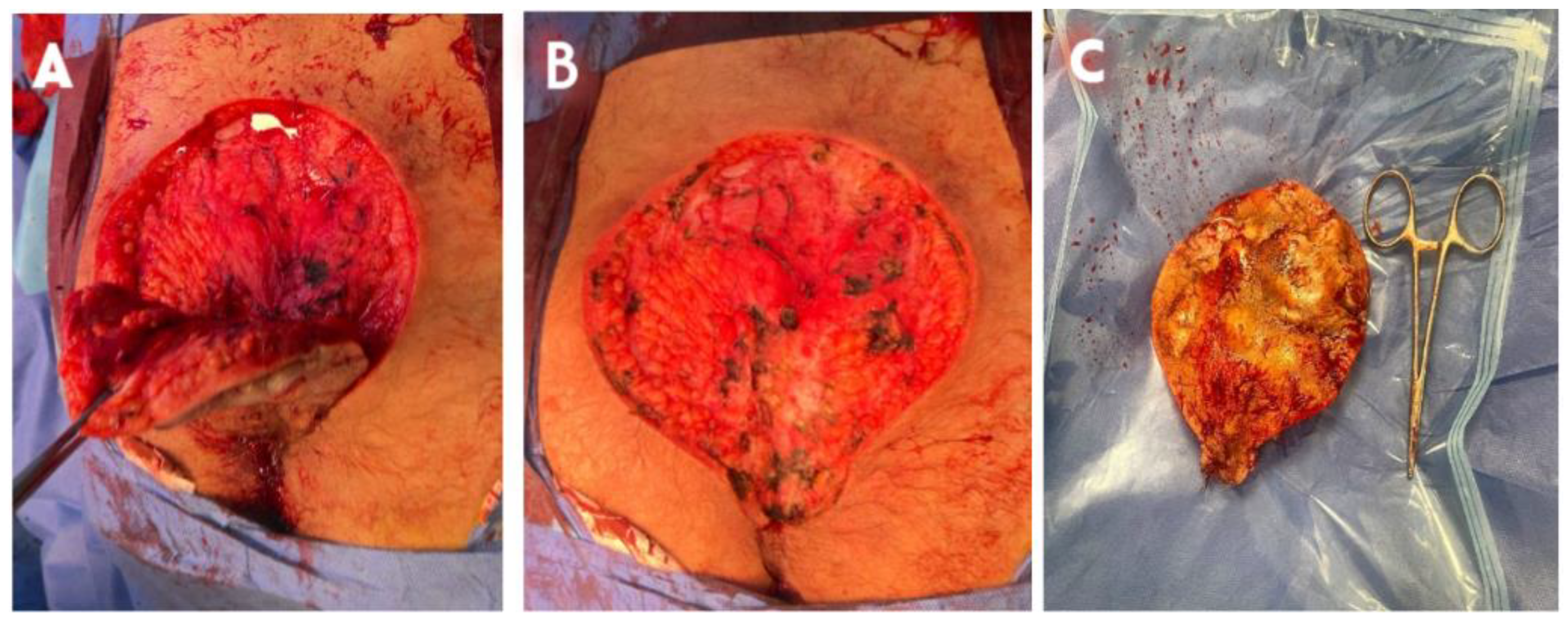 Preprints 174140 g004