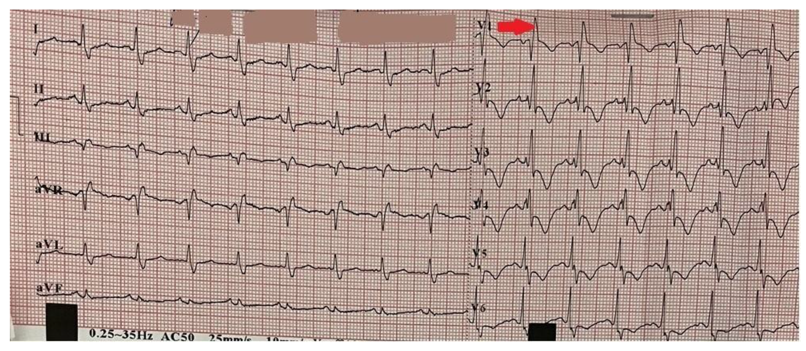 Preprints 165955 g001