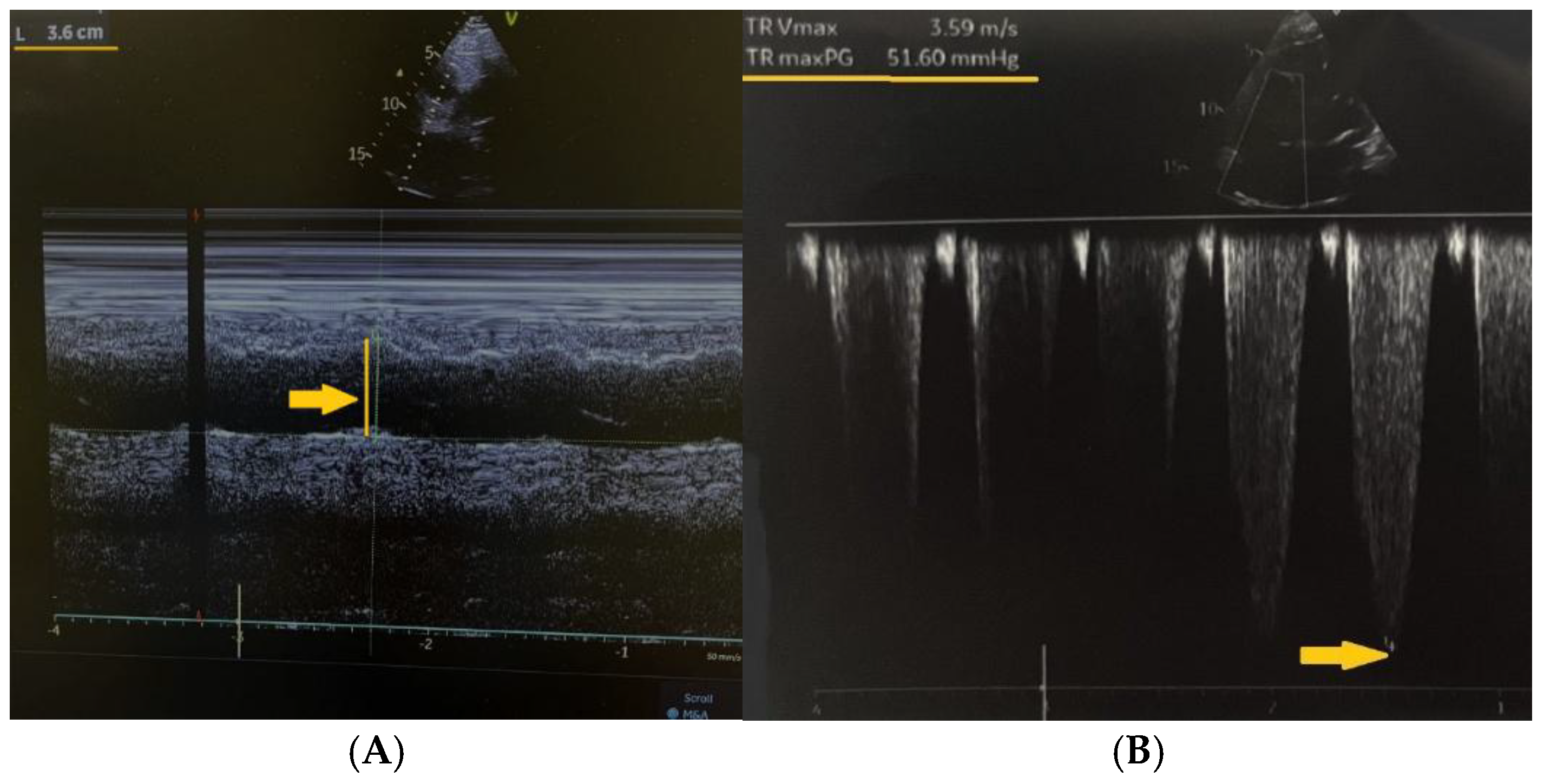 Preprints 165955 g002