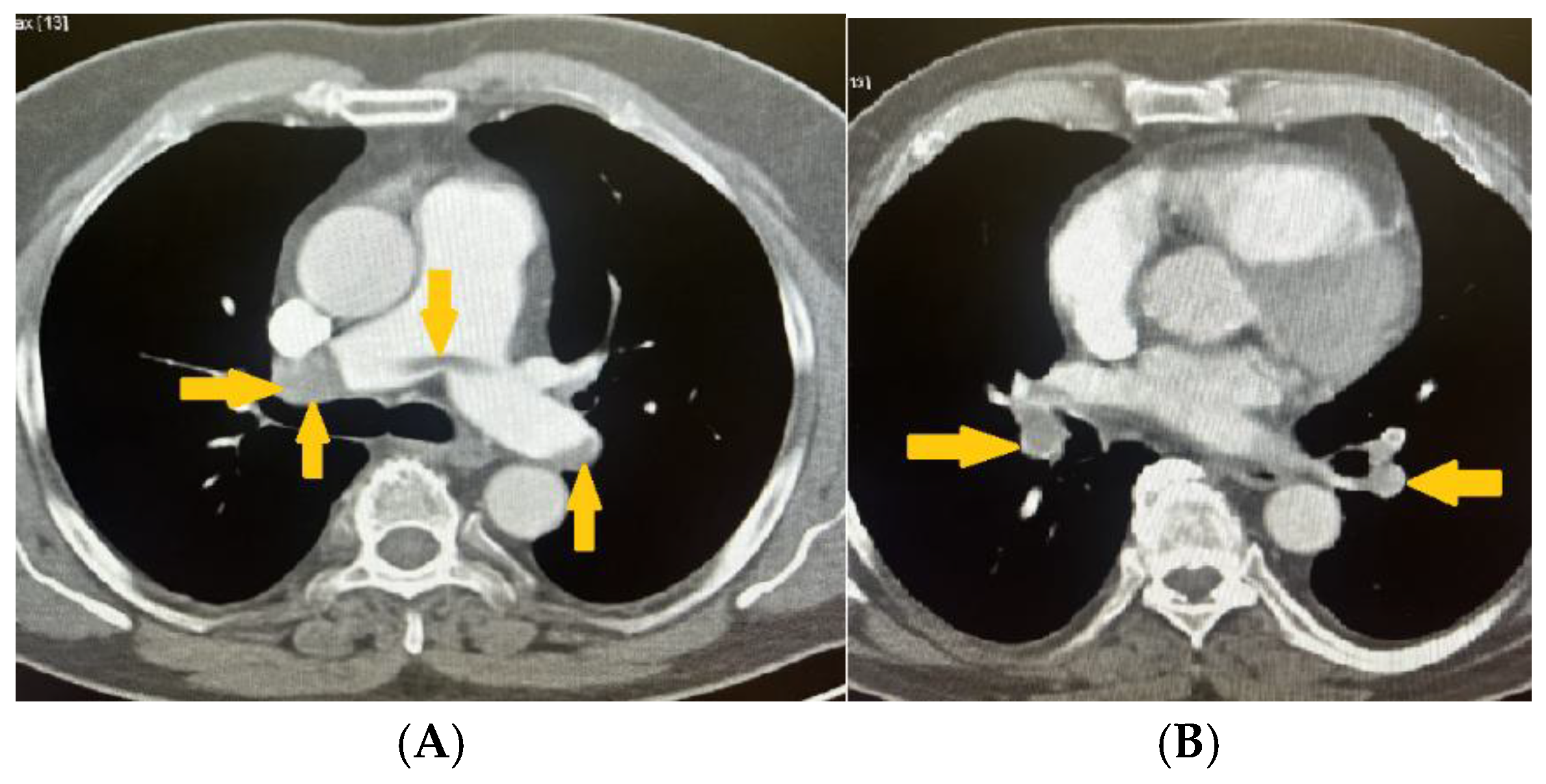 Preprints 165955 g004