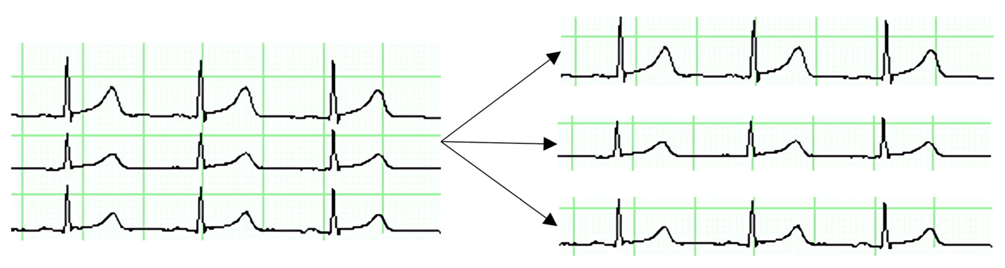 Preprints 139365 g015