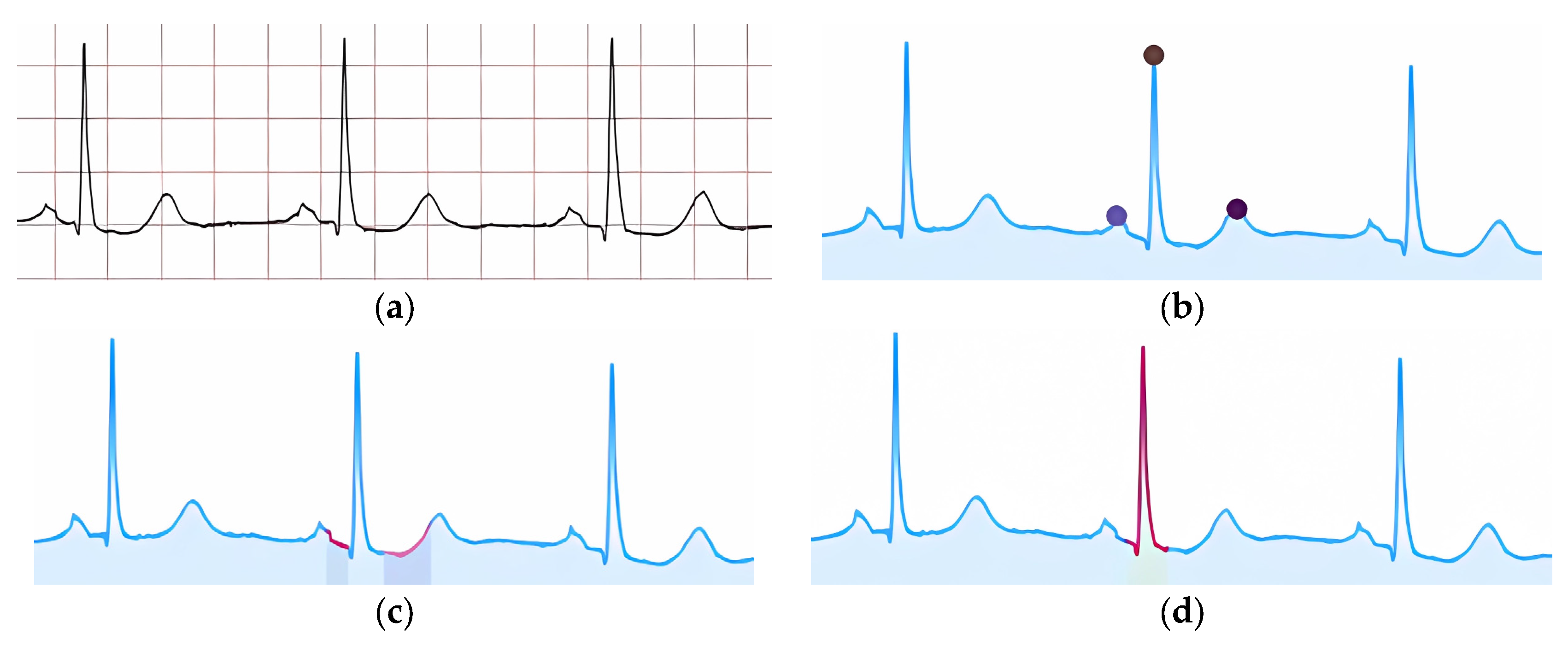 Preprints 139365 g017