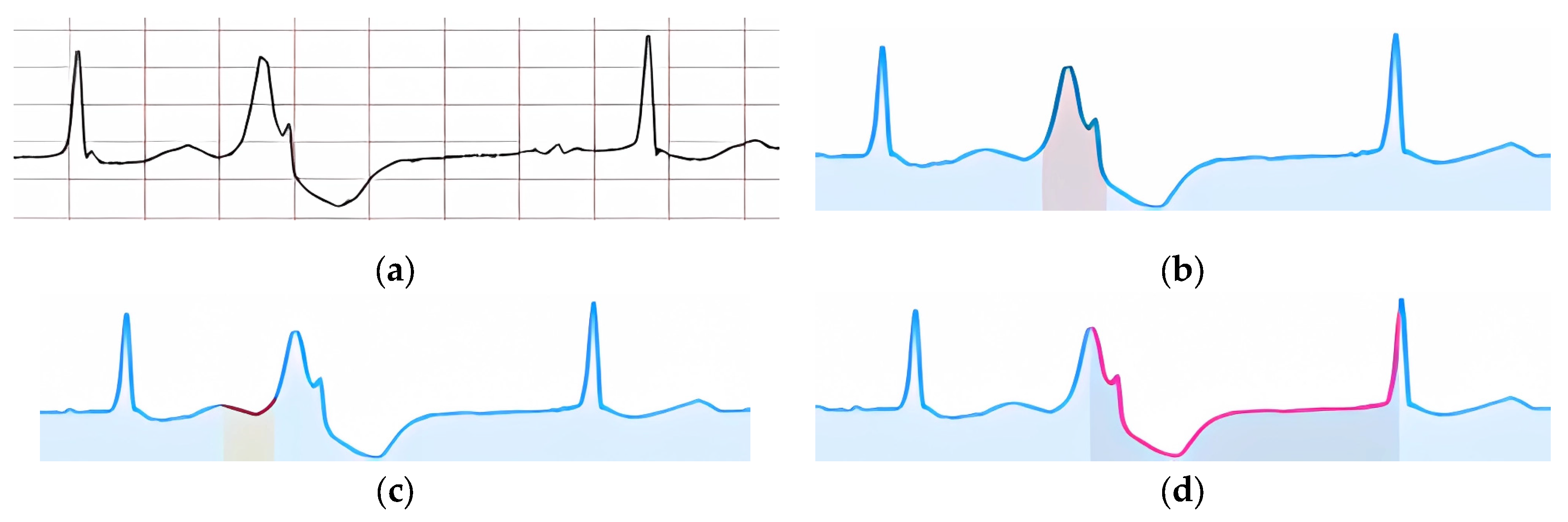 Preprints 139365 g020