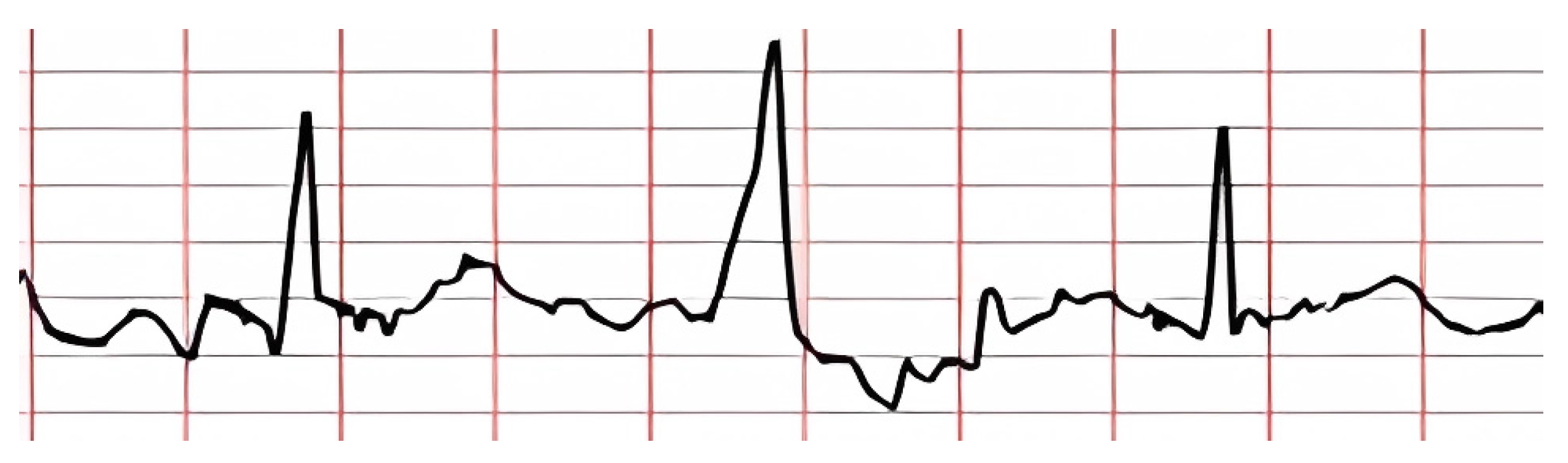Preprints 139365 g021