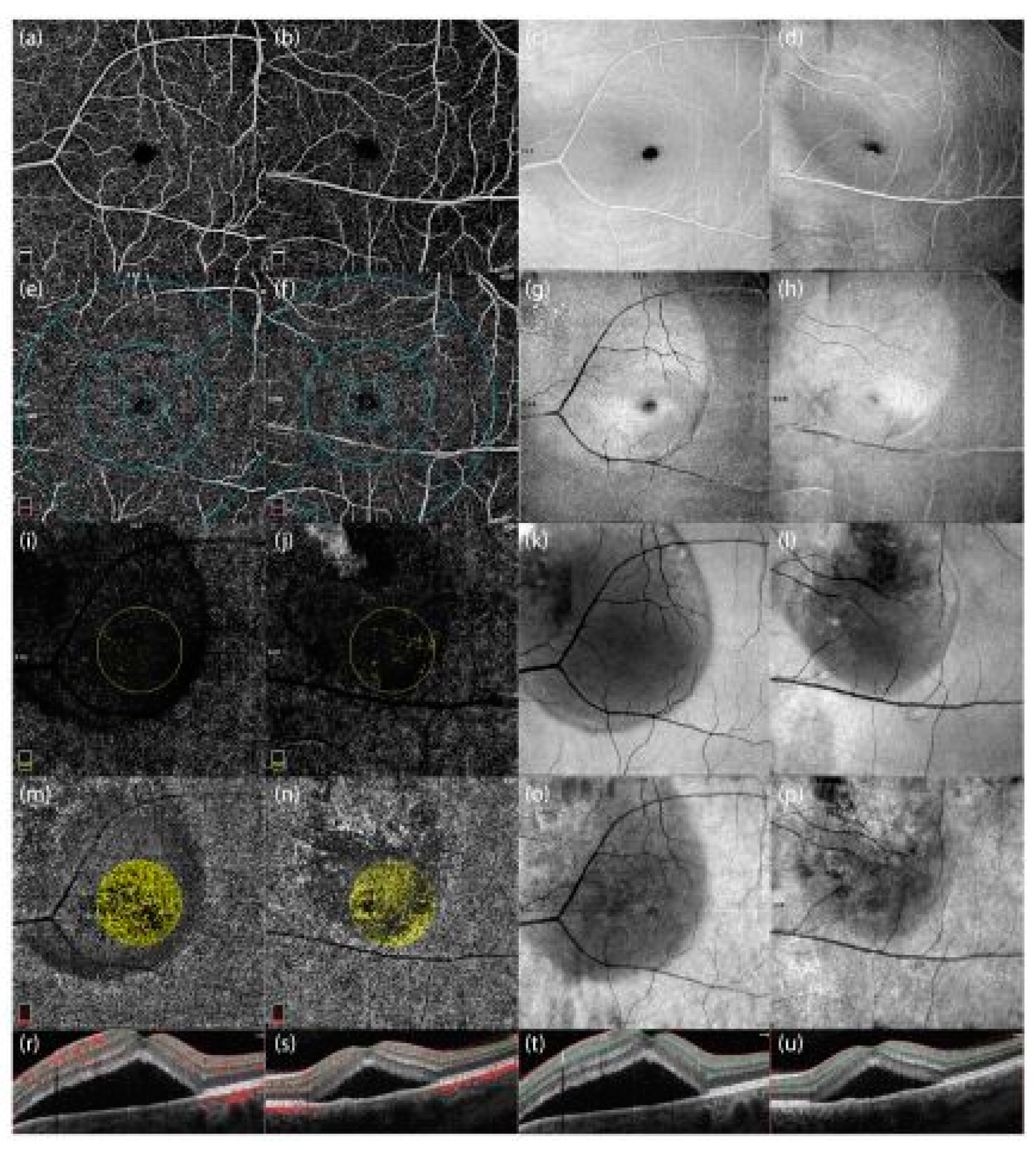 Preprints 142569 g004