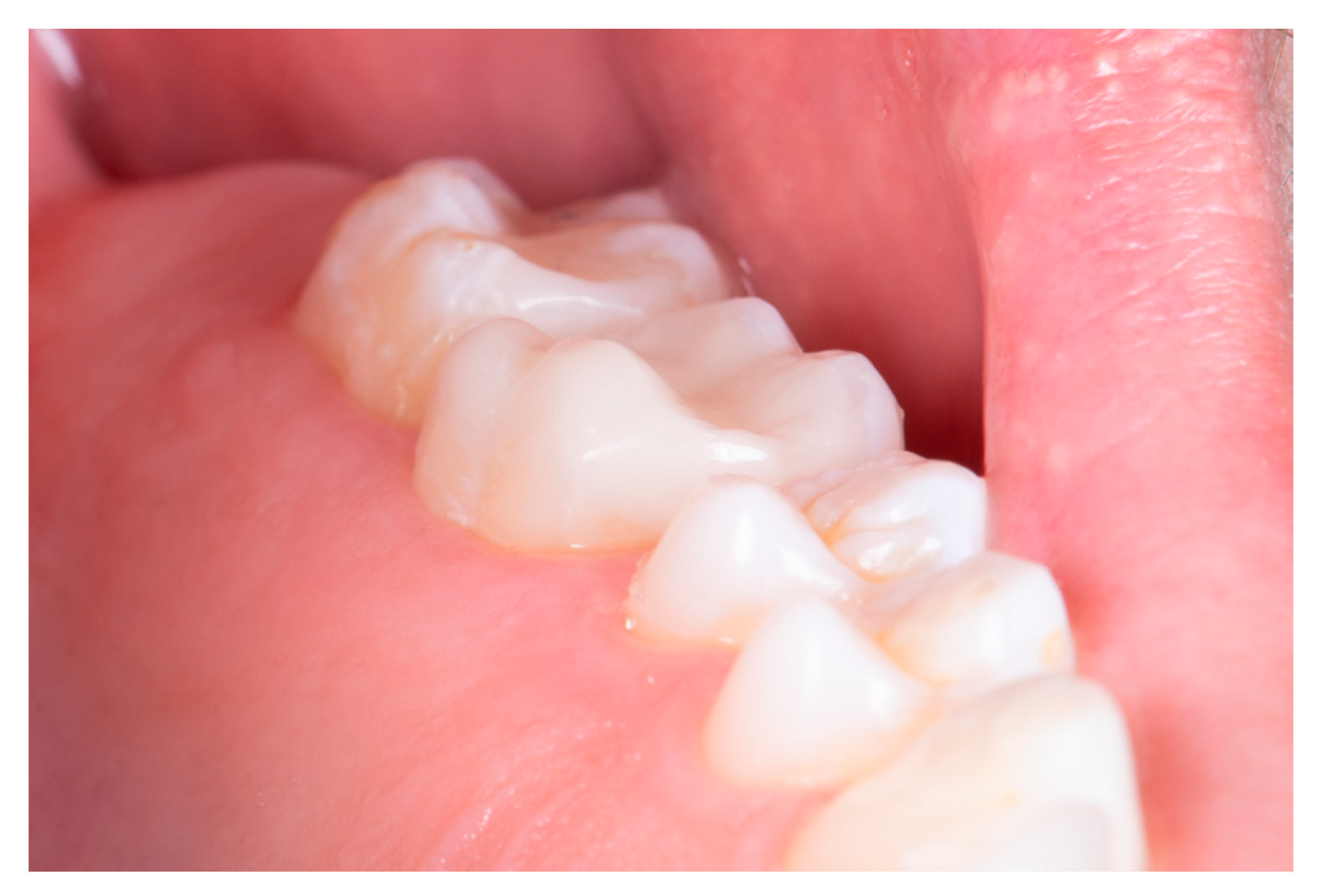 Preprints 153601 g013