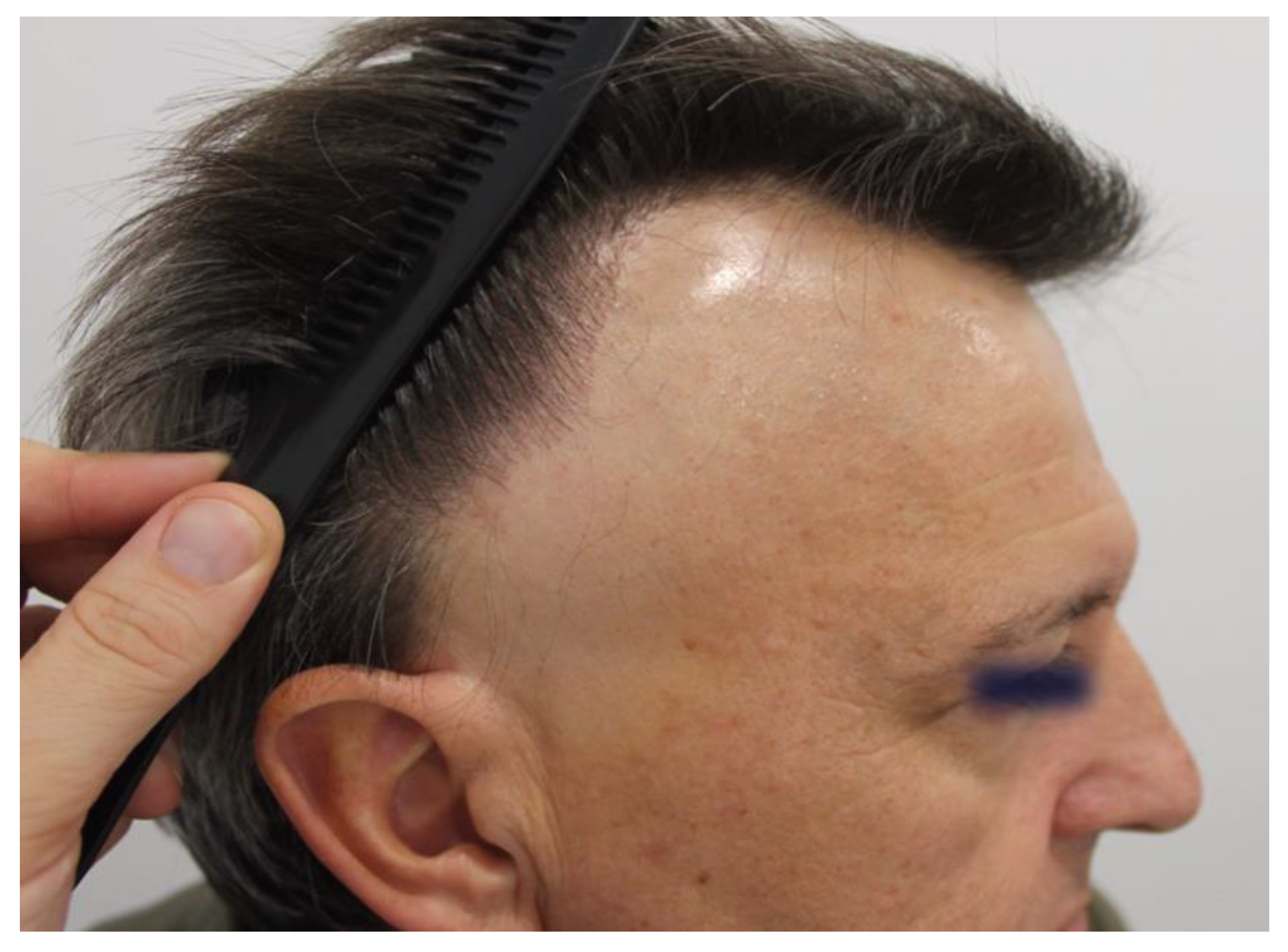 Preprints 148227 g007