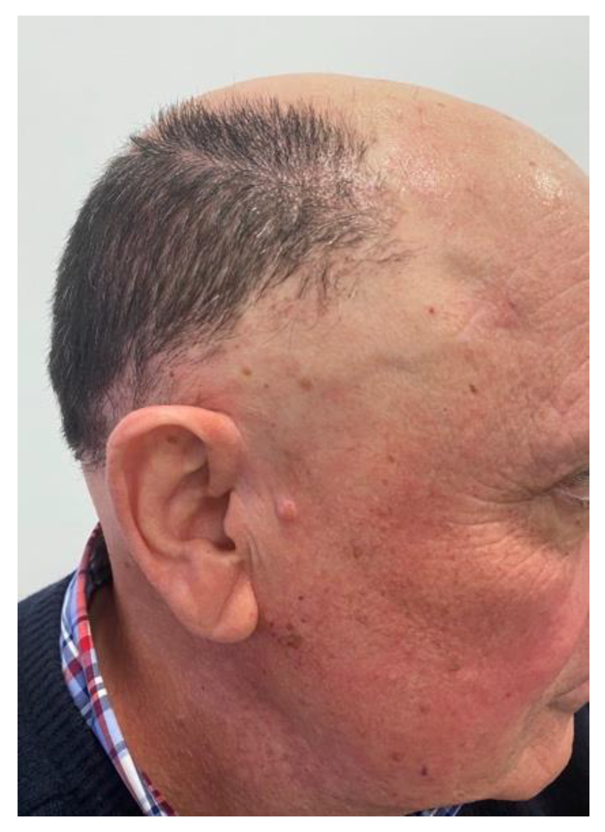 Preprints 148227 g010