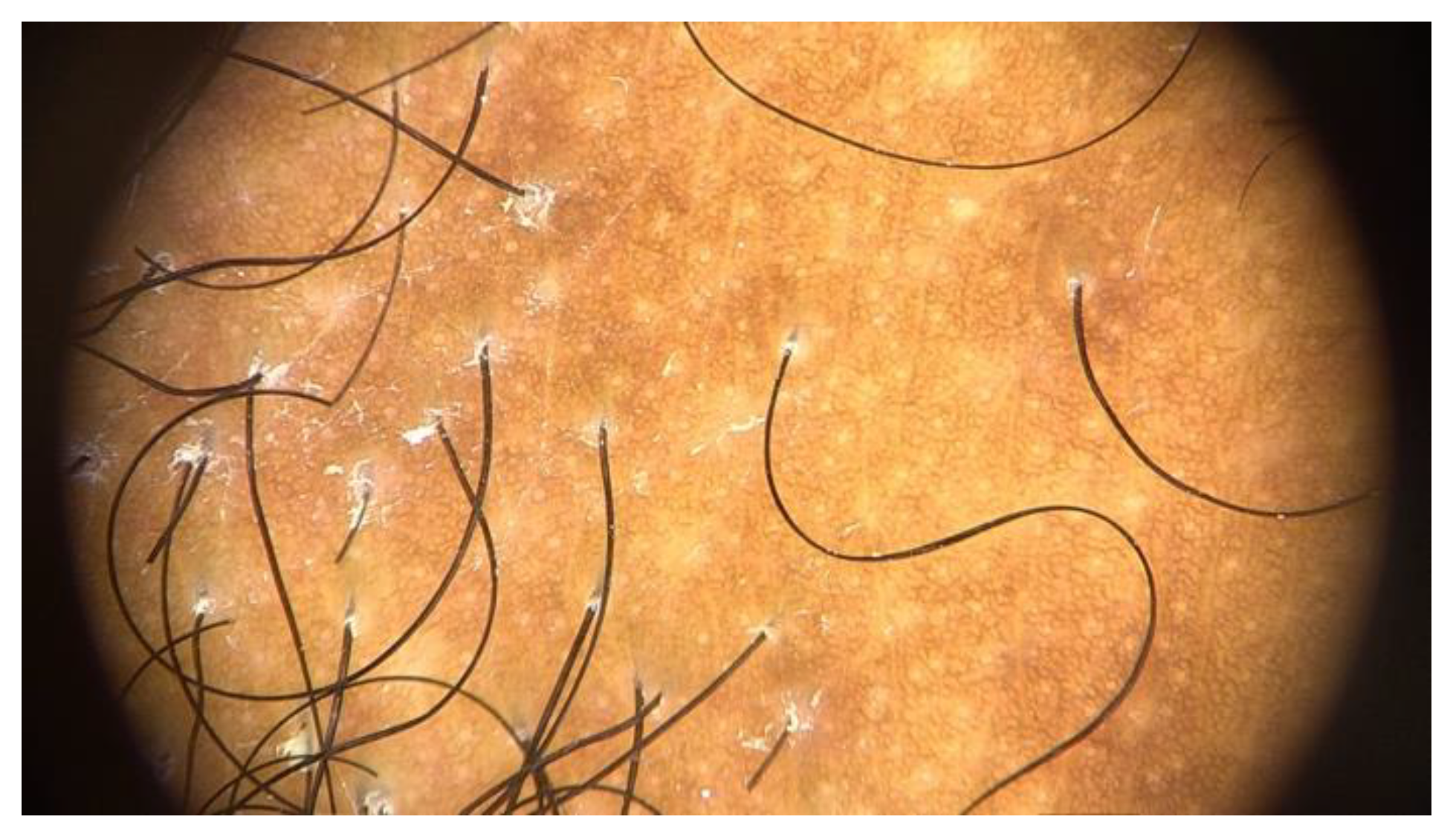 Preprints 148227 g011