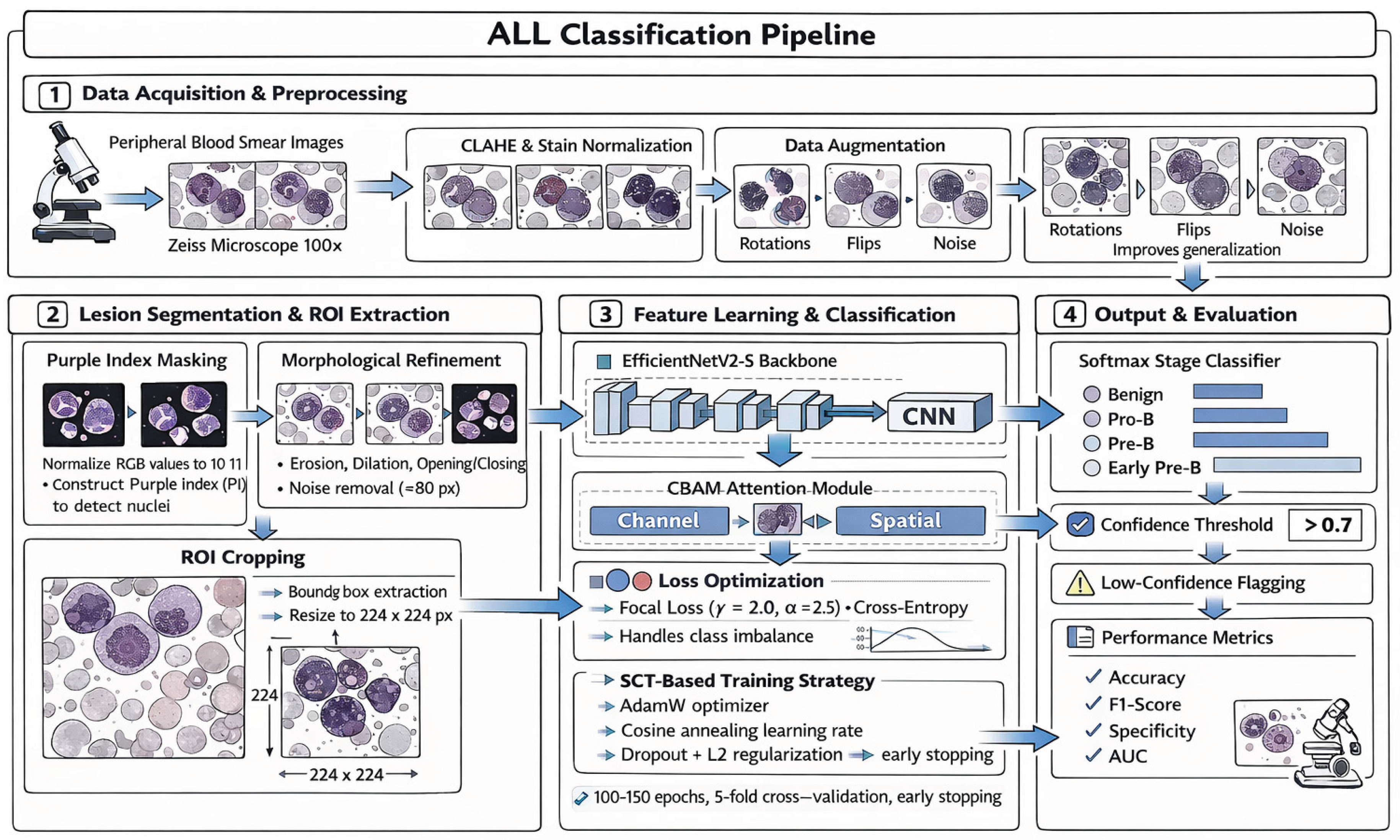 A Lightweight Hybrid CNN–CBAM Model for Multistage Acute Lymphoblastic ...