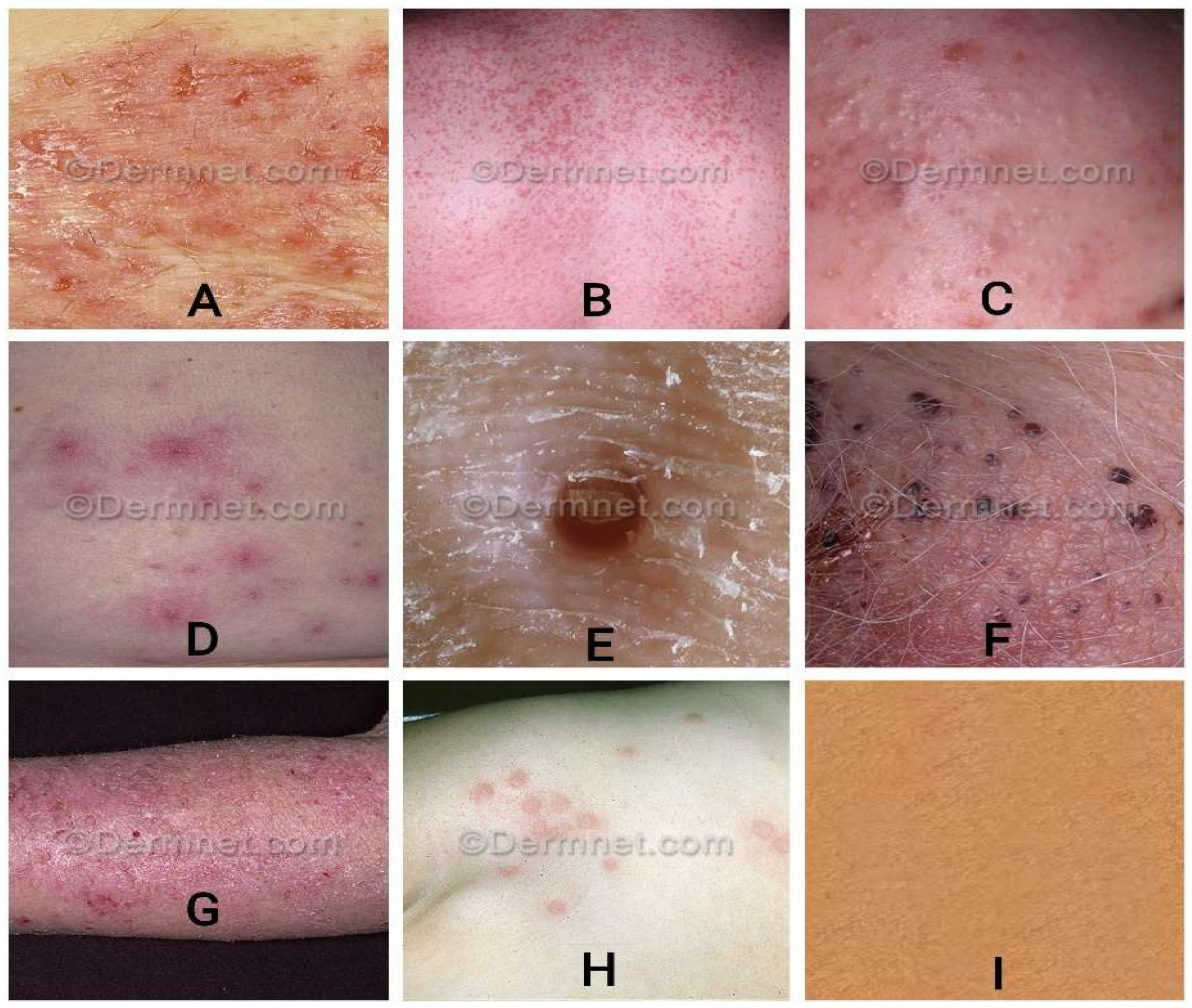 Preprints 170881 g006