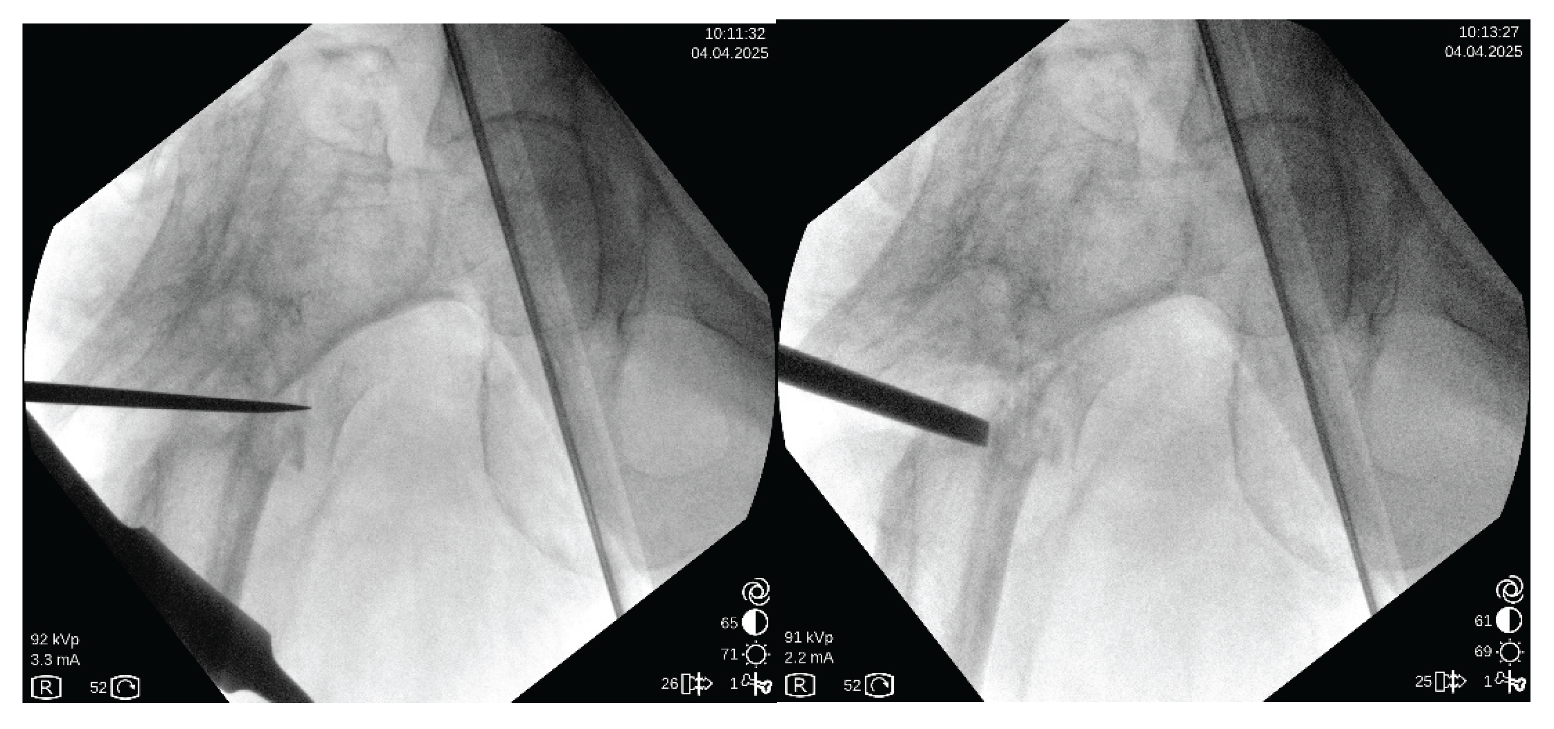 Preprints 173801 g005