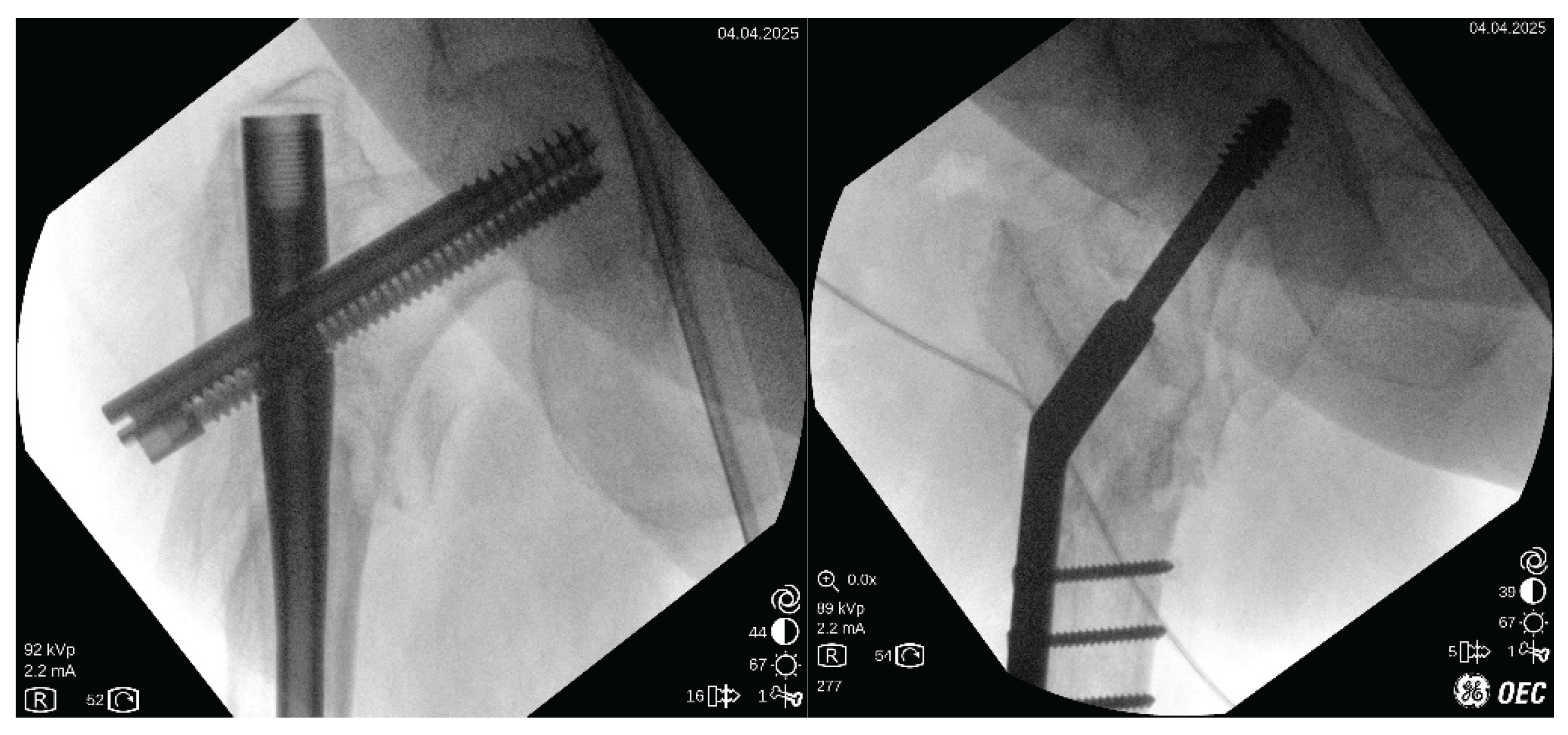 Preprints 173801 g007