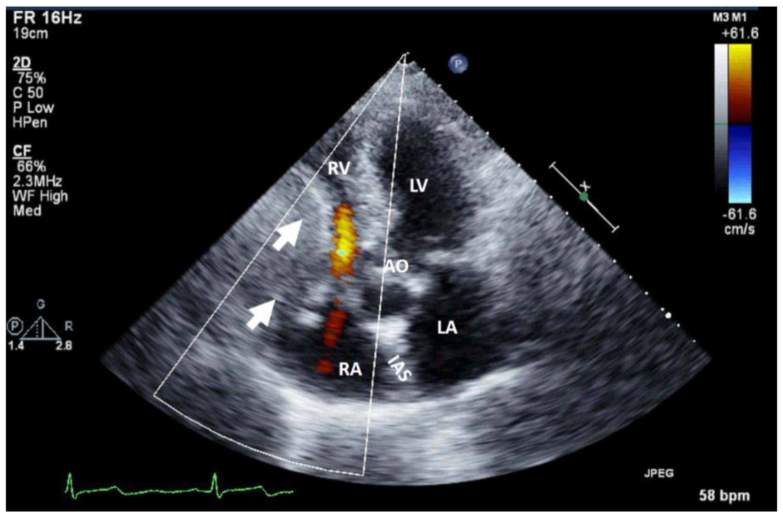 Preprints 95842 g001