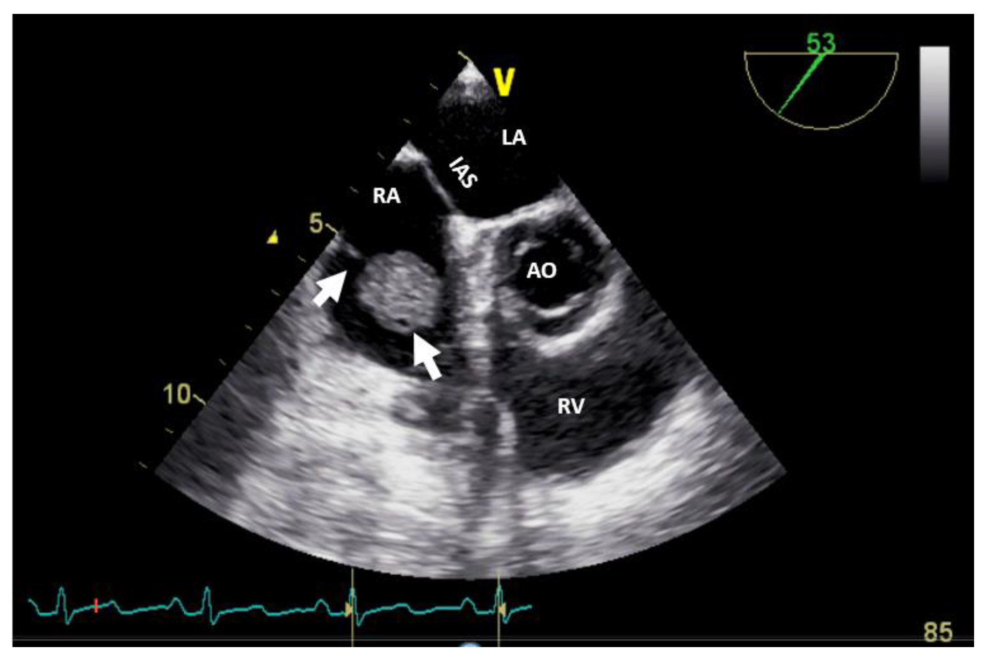 Preprints 95842 g005