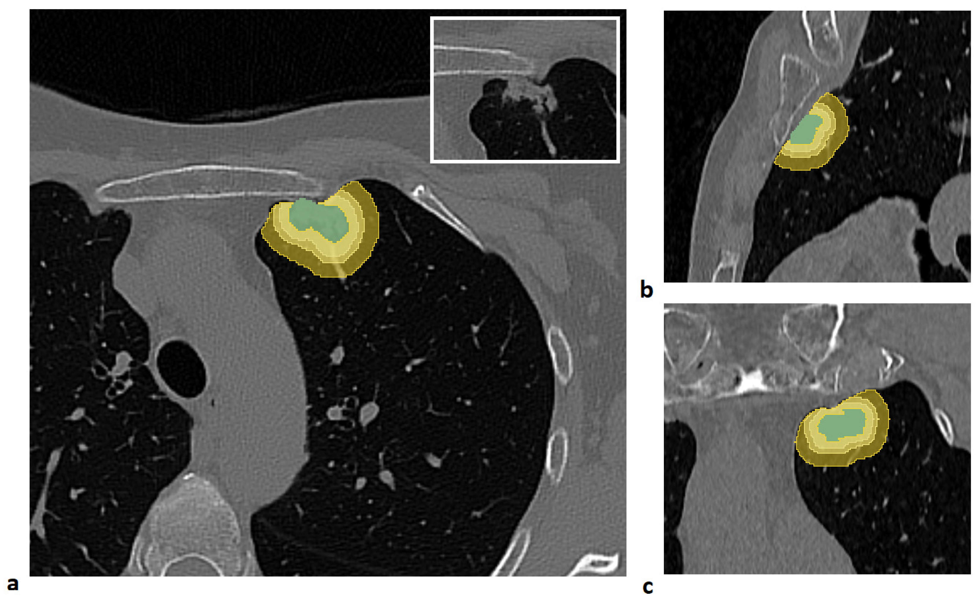 Preprints 182968 g001