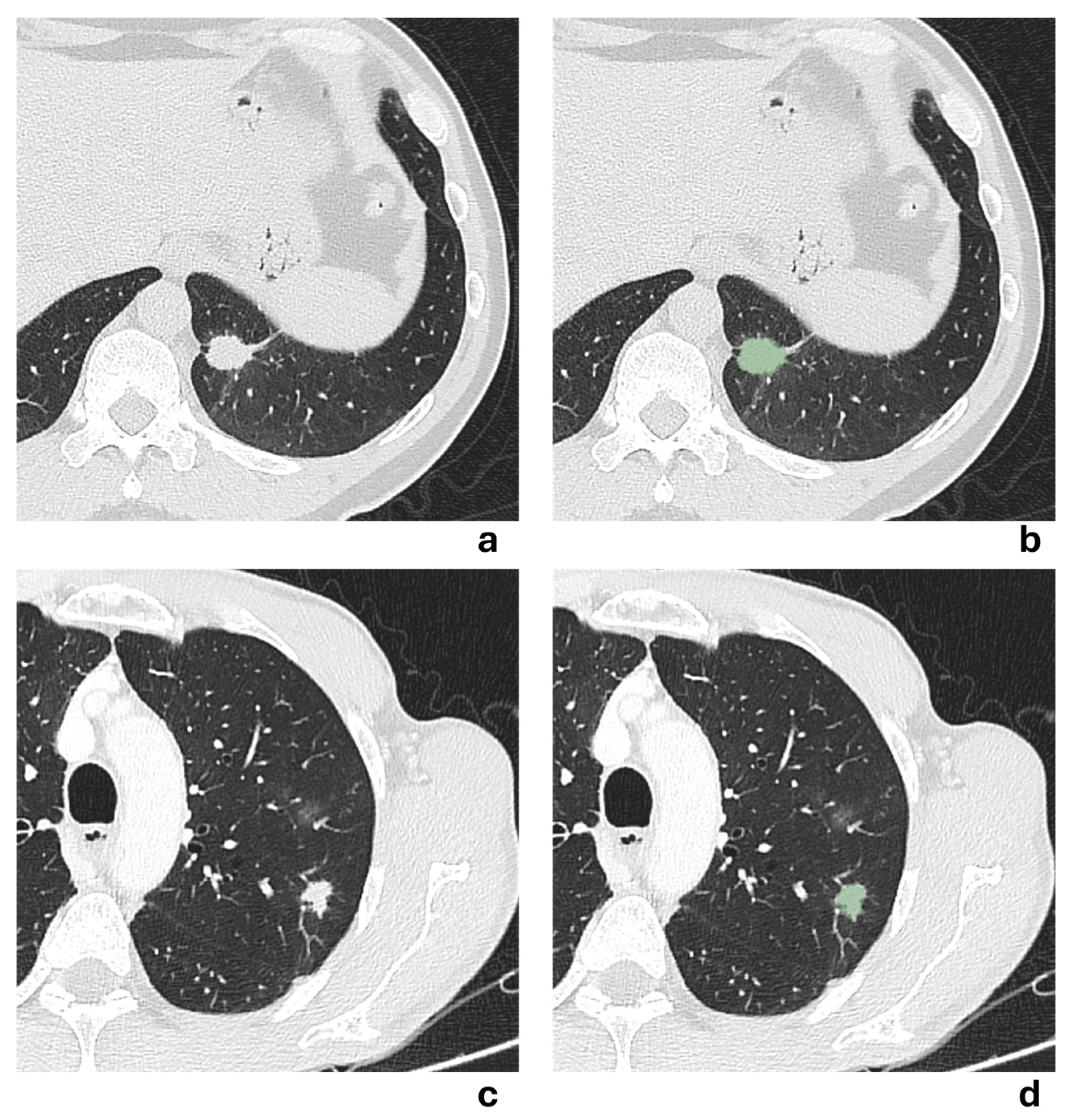 Preprints 182968 g005