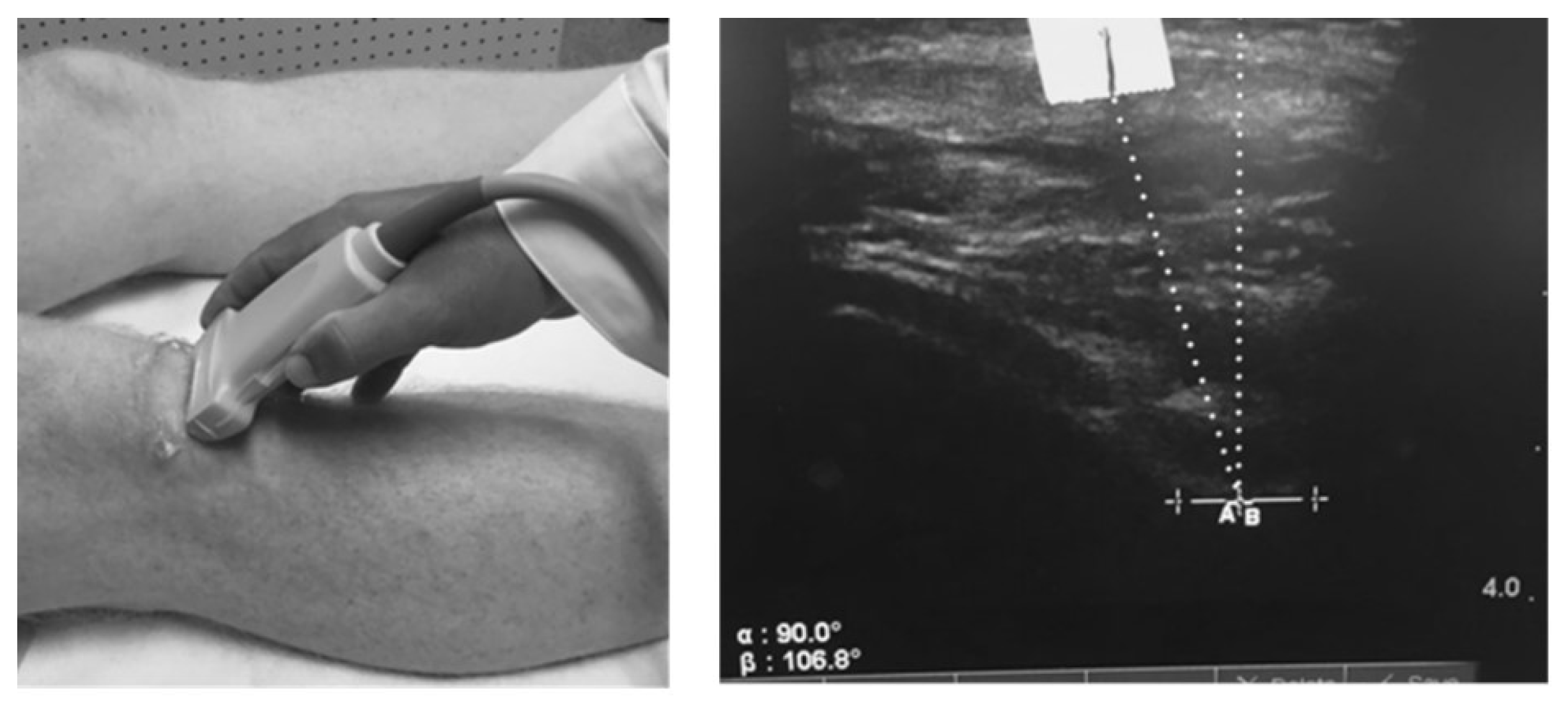 Preprints 149953 g001