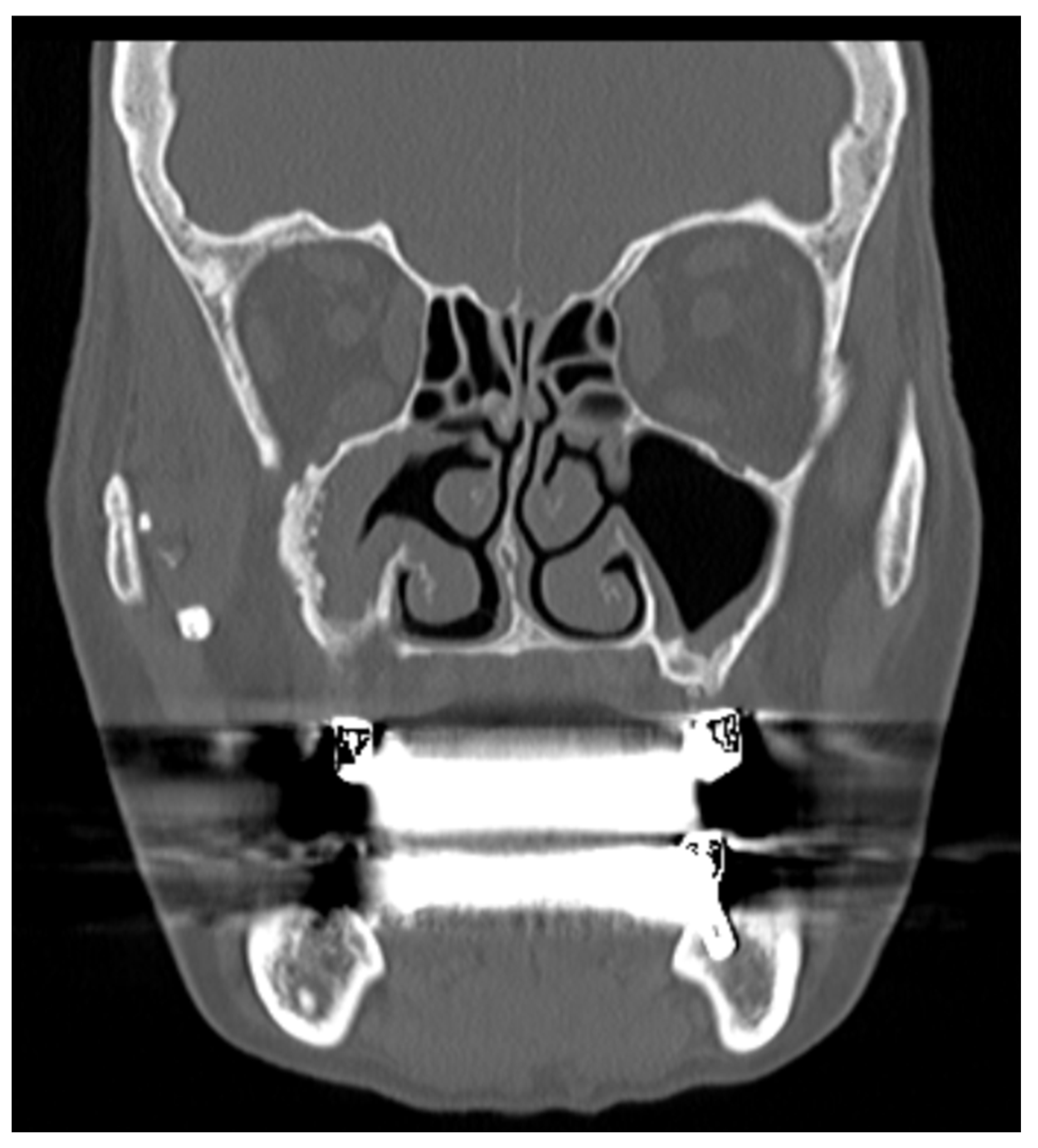 Preprints 161883 g001