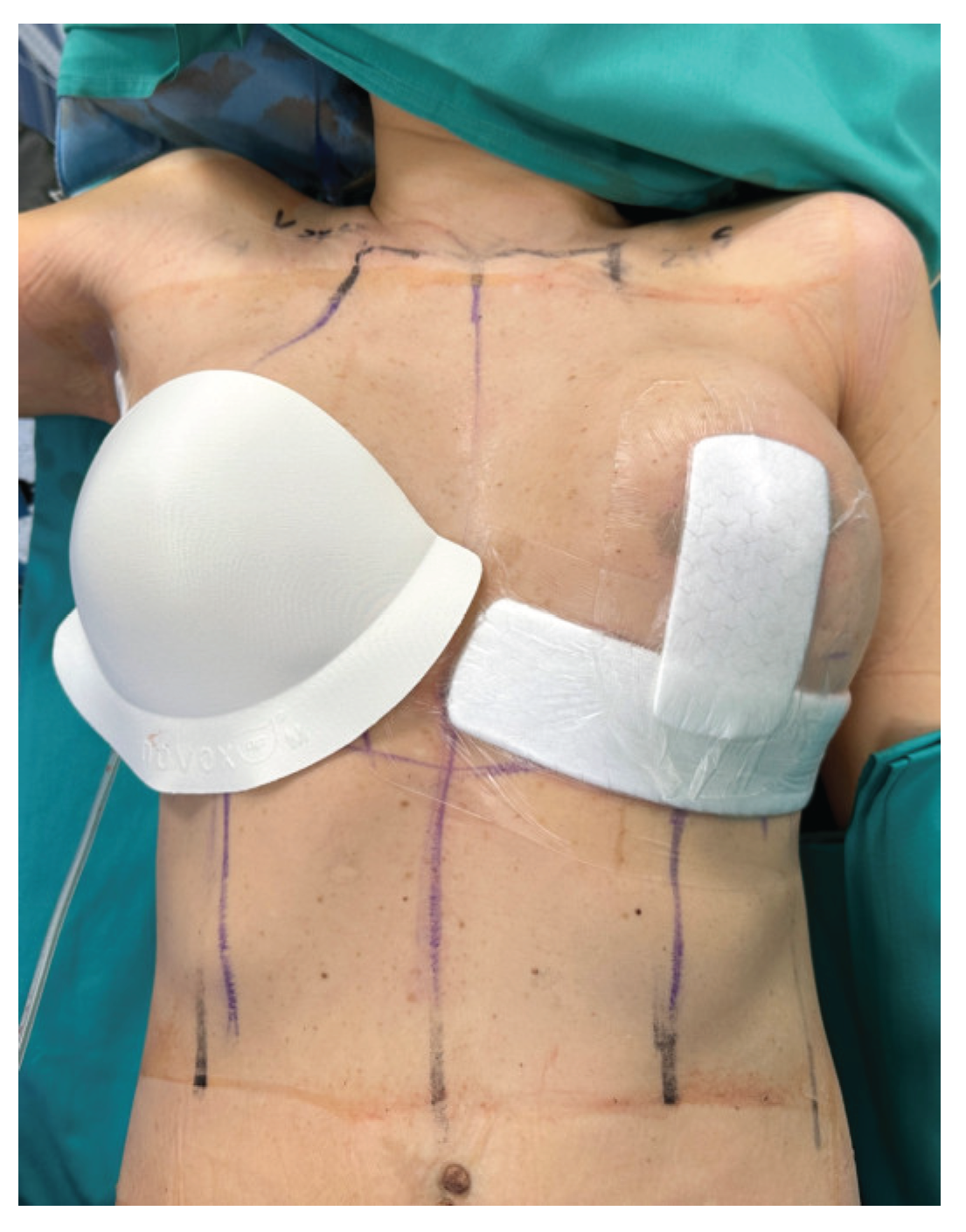 Preprints 187180 g001