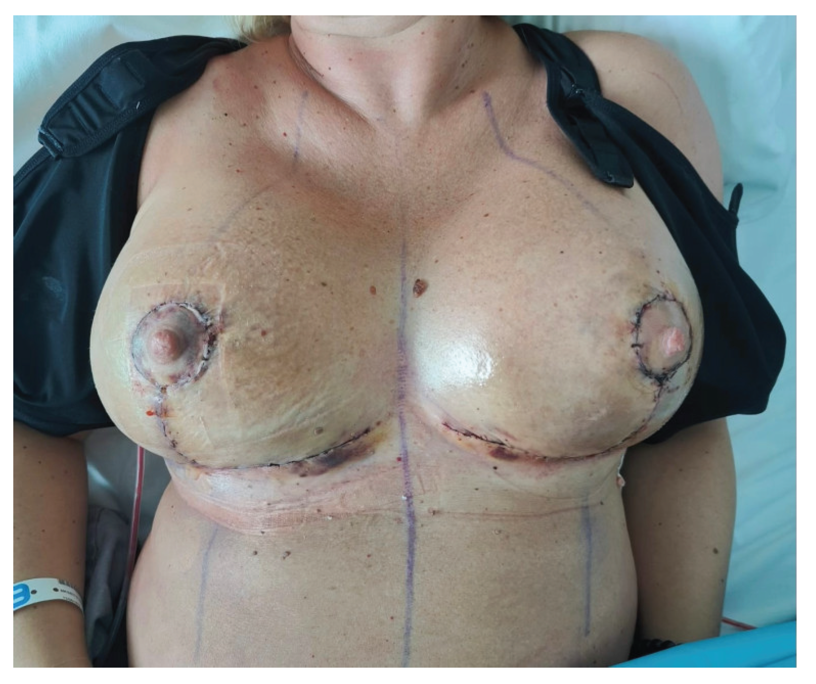 Preprints 187180 g002