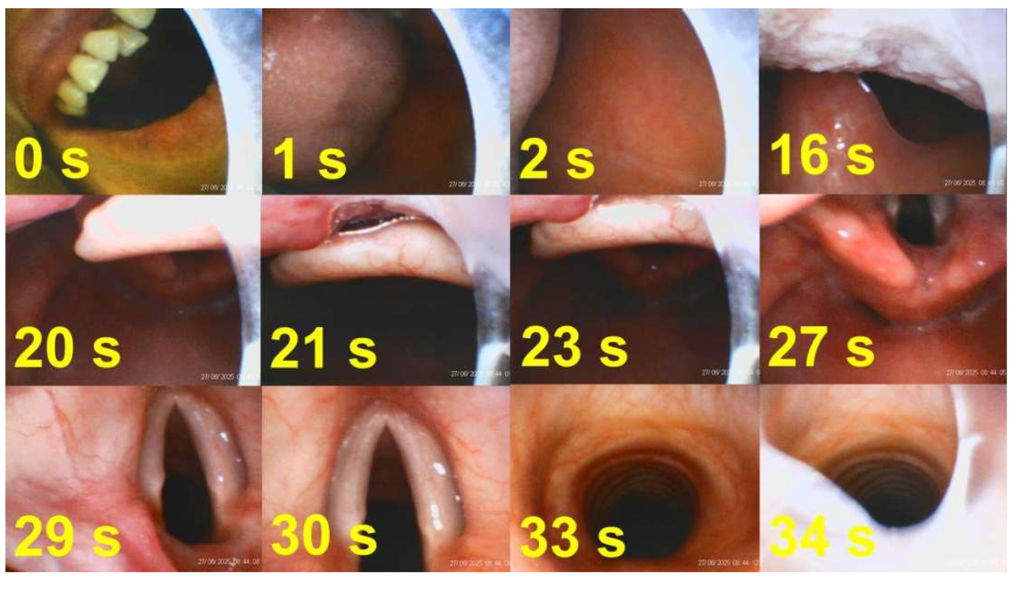 Preprints 171526 g008