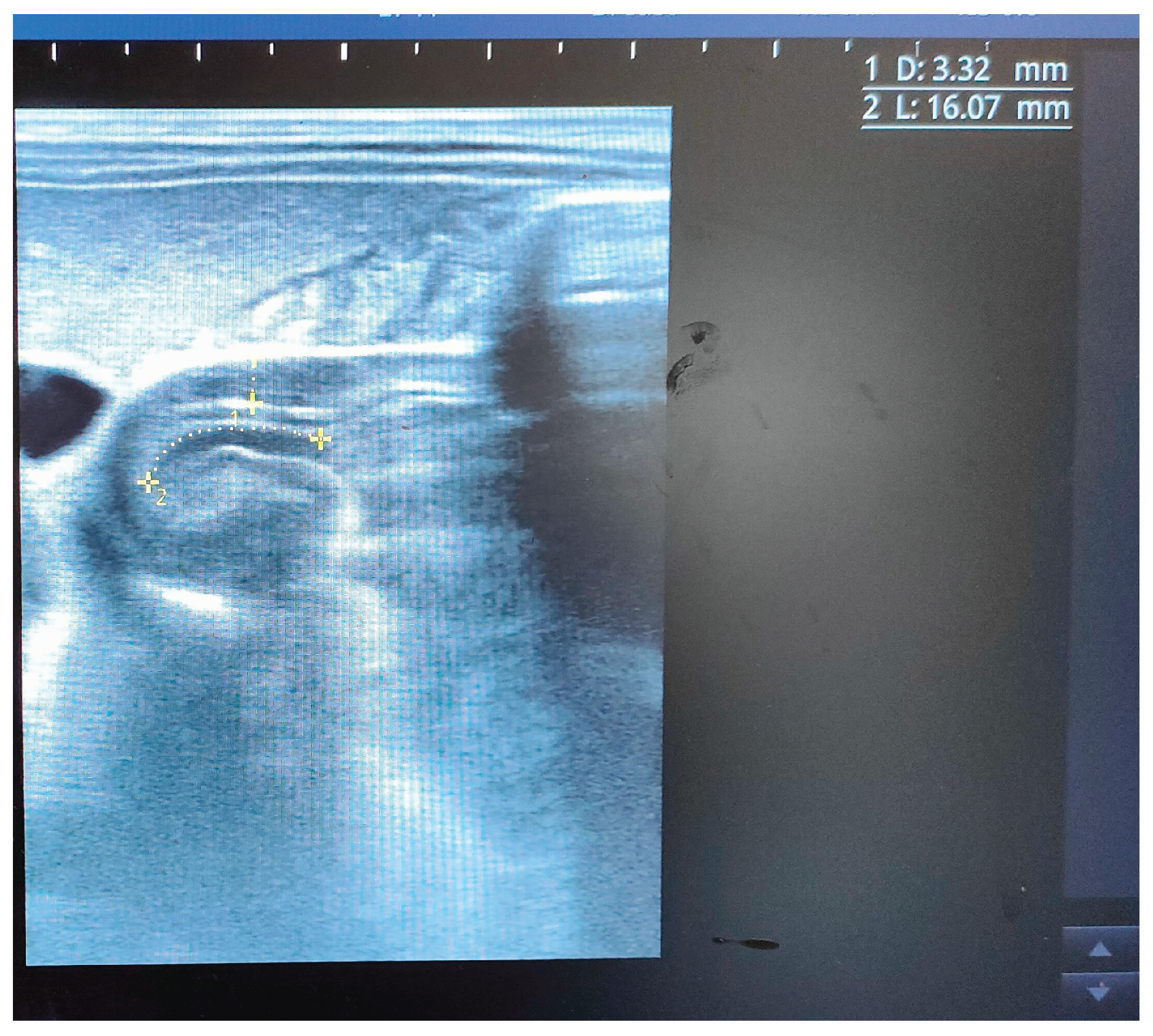 Preprints 181123 g004