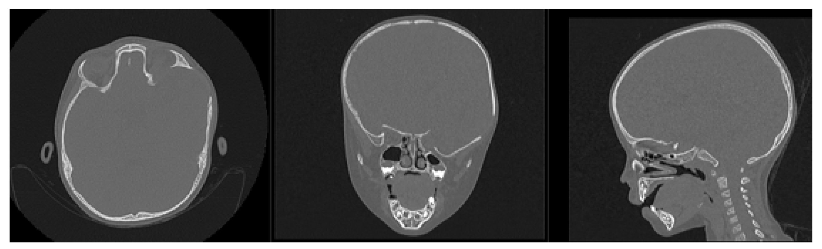 Preprints 168065 g002