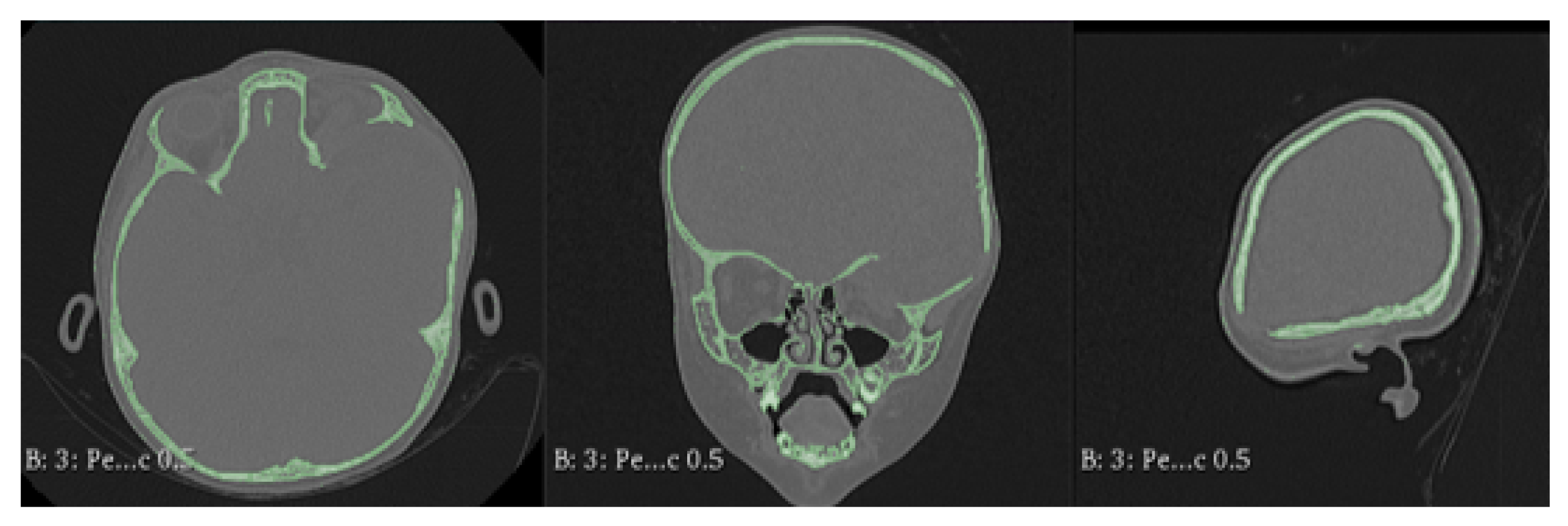 Preprints 168065 g003