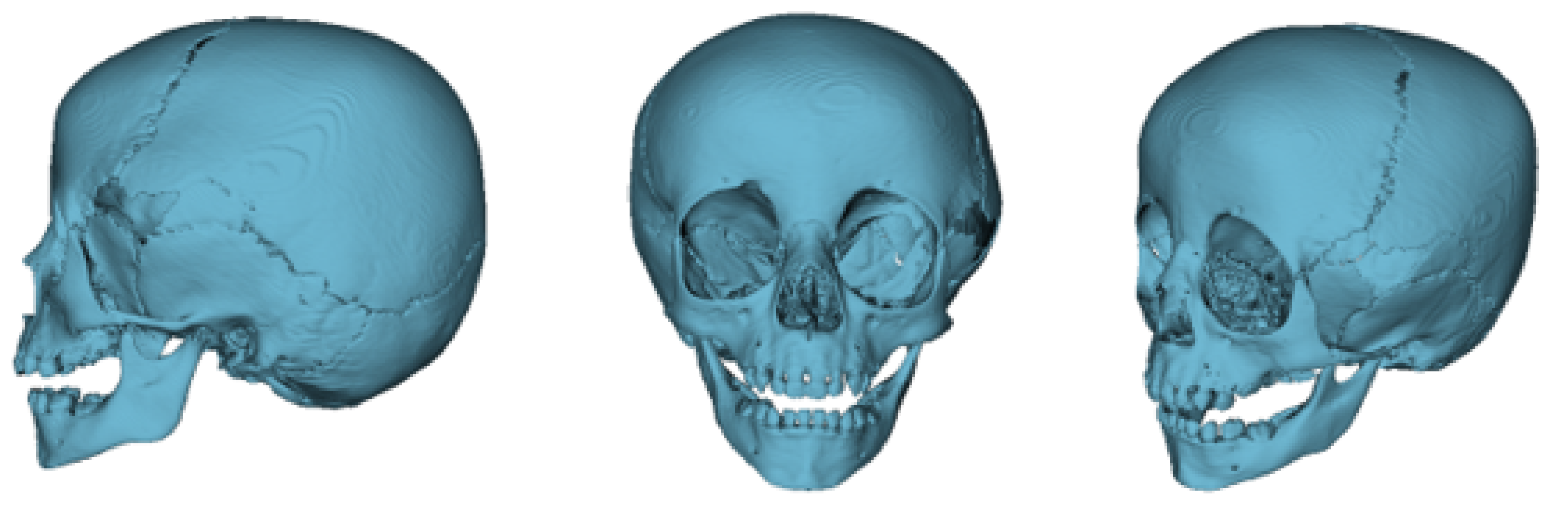Preprints 168065 g004