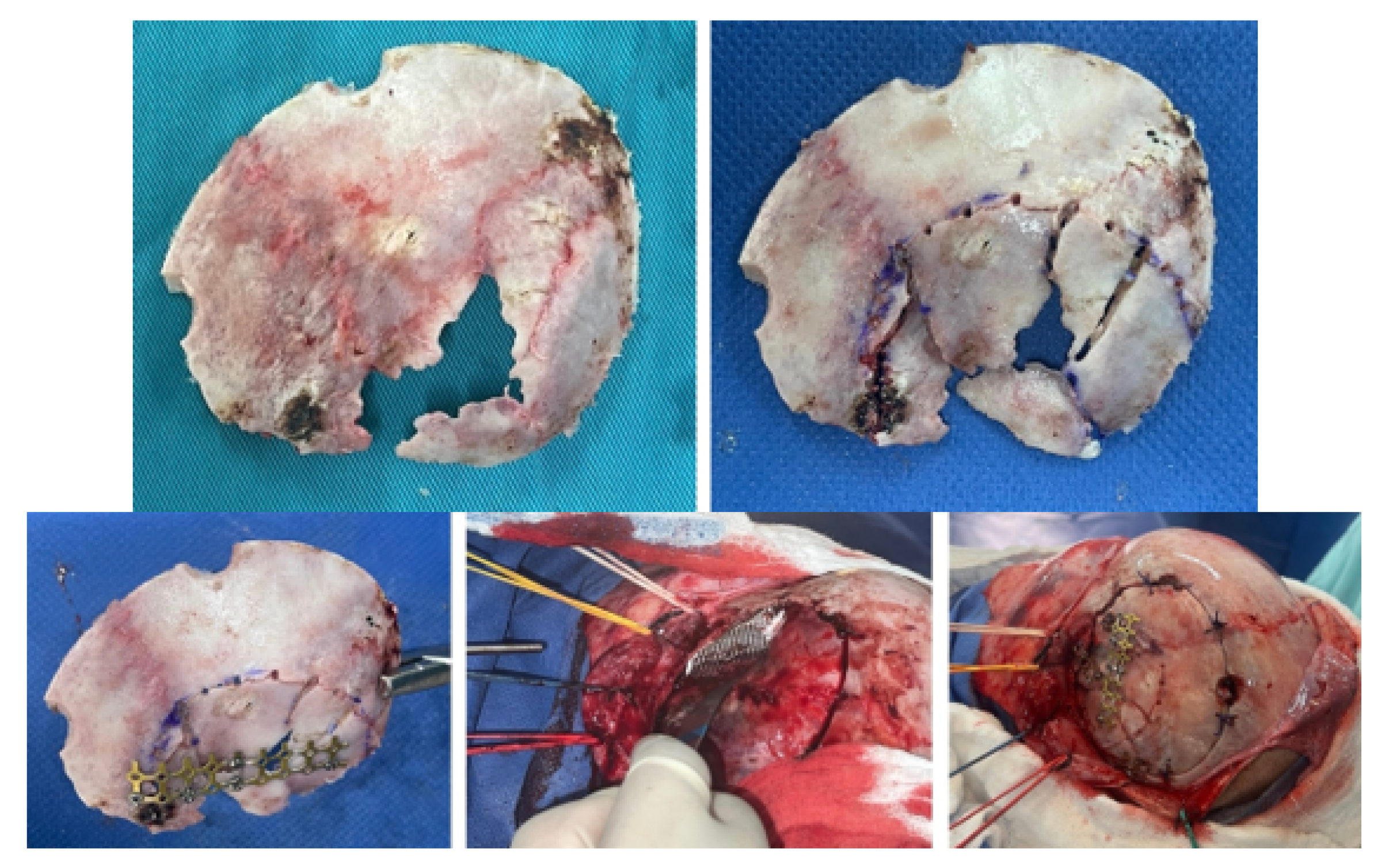 Preprints 168065 g007