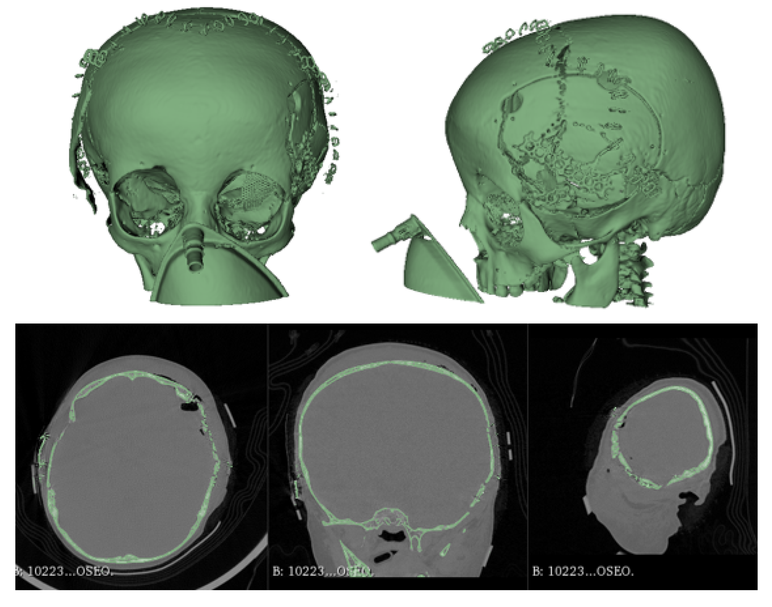 Preprints 168065 g008